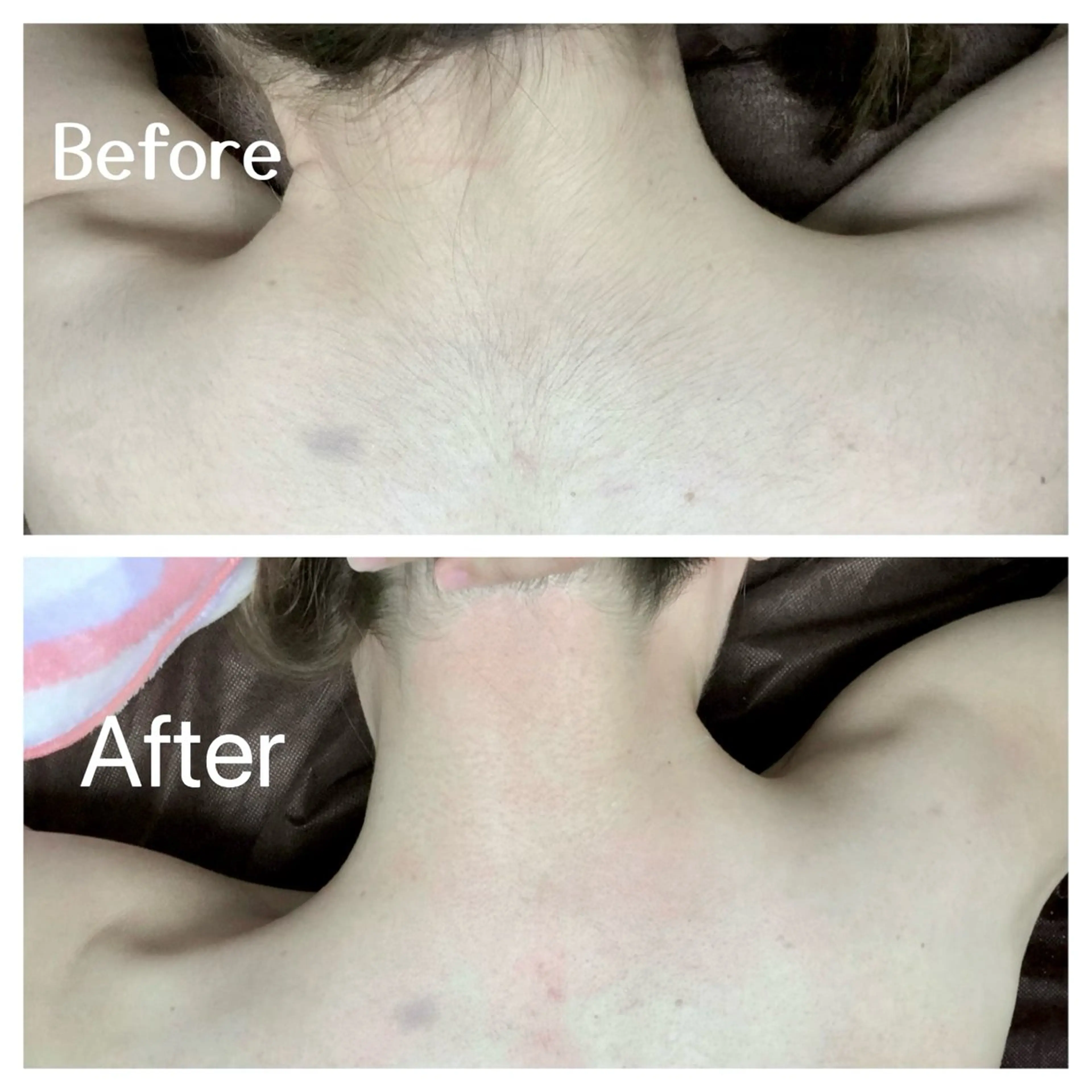 川越デリケートゾーン 光脱毛/ワックス脱毛のエステ・リラクイメージ