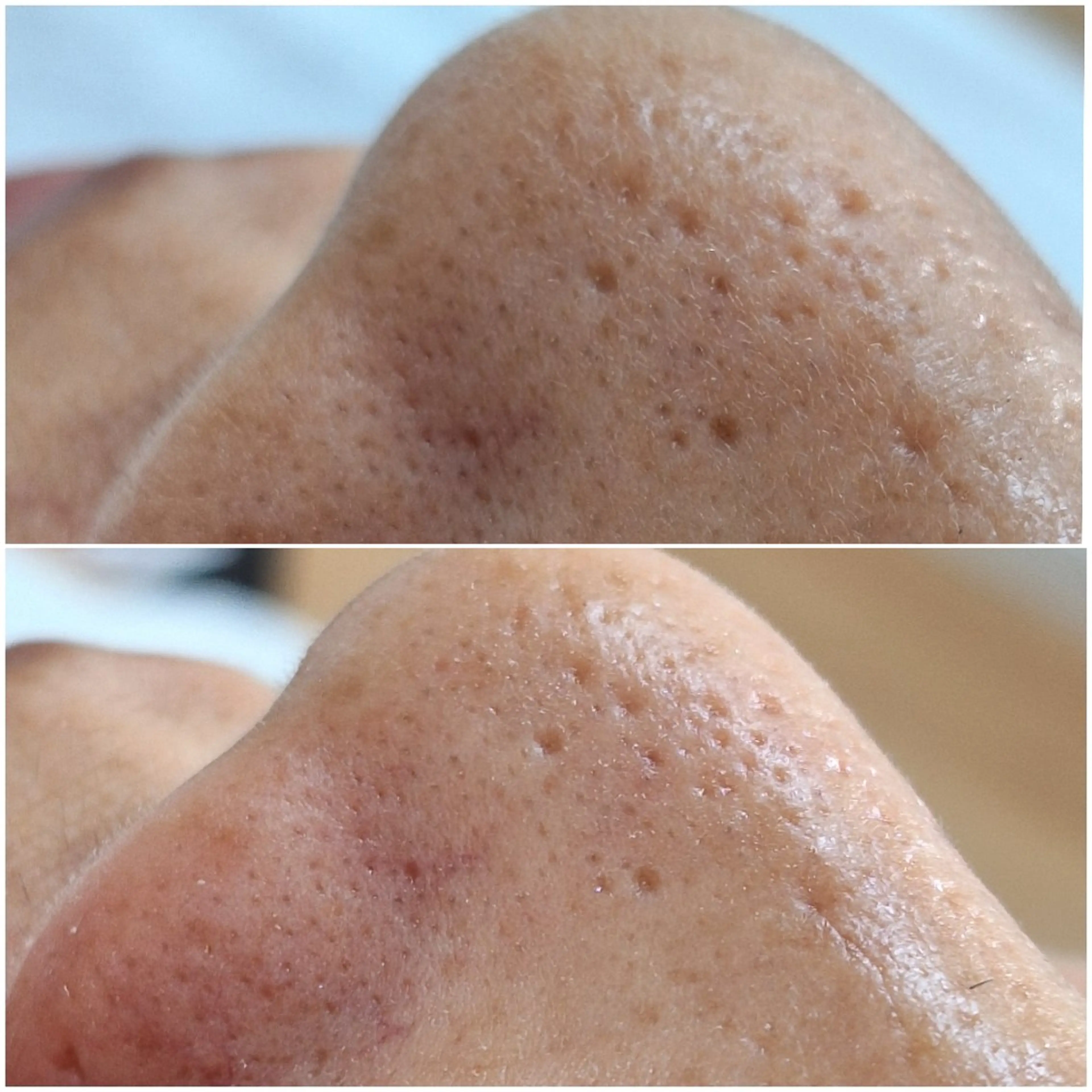 eyelash  Recona のマツエク・マツパデザイン