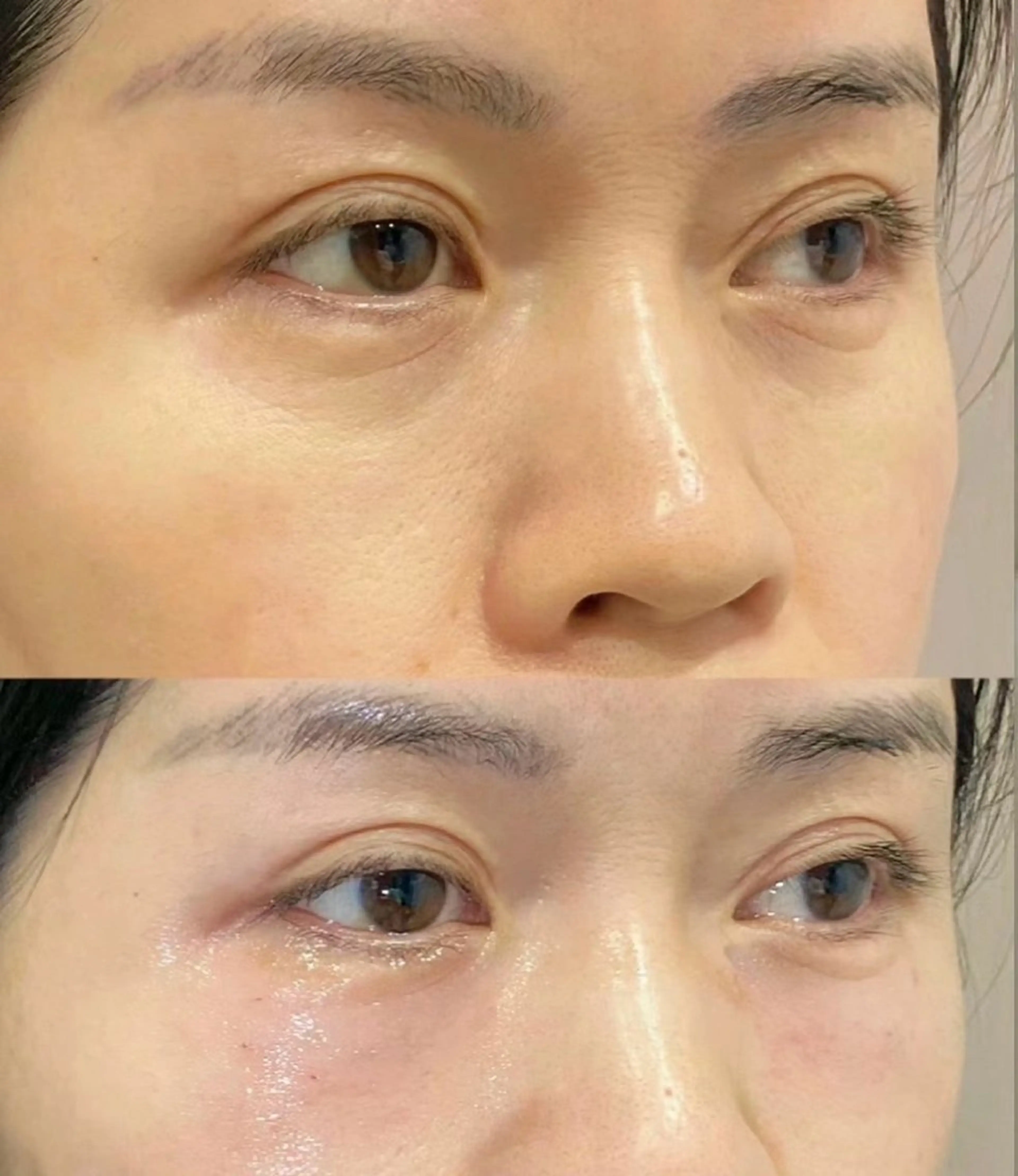 エステ リラク 愛維美水光美肌専門店所属・愛維美水光美肌専門店 メンズレディースokのエステ・リラクイメージ