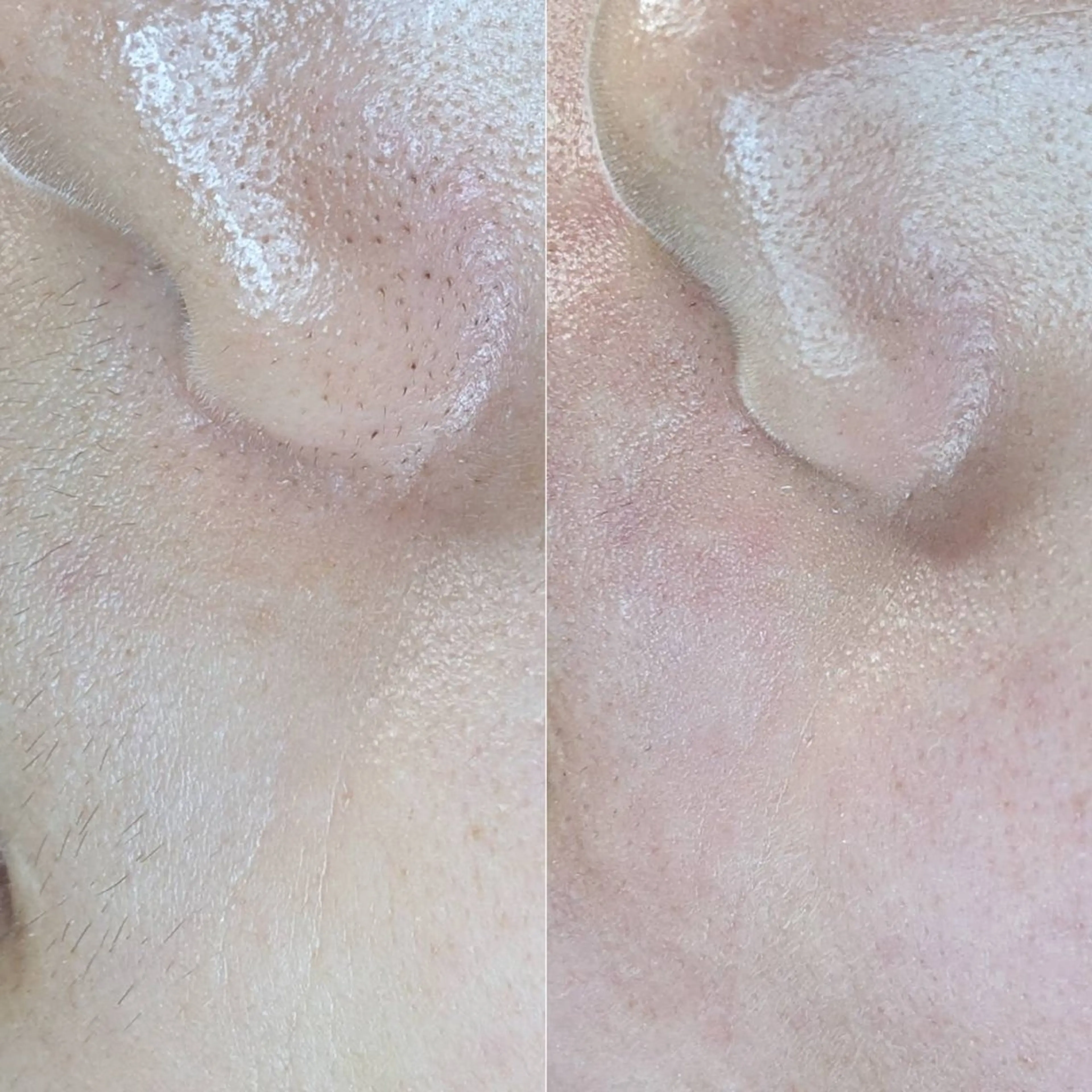 saki 束感まつ毛/ 大阪のマツエク・マツパデザイン