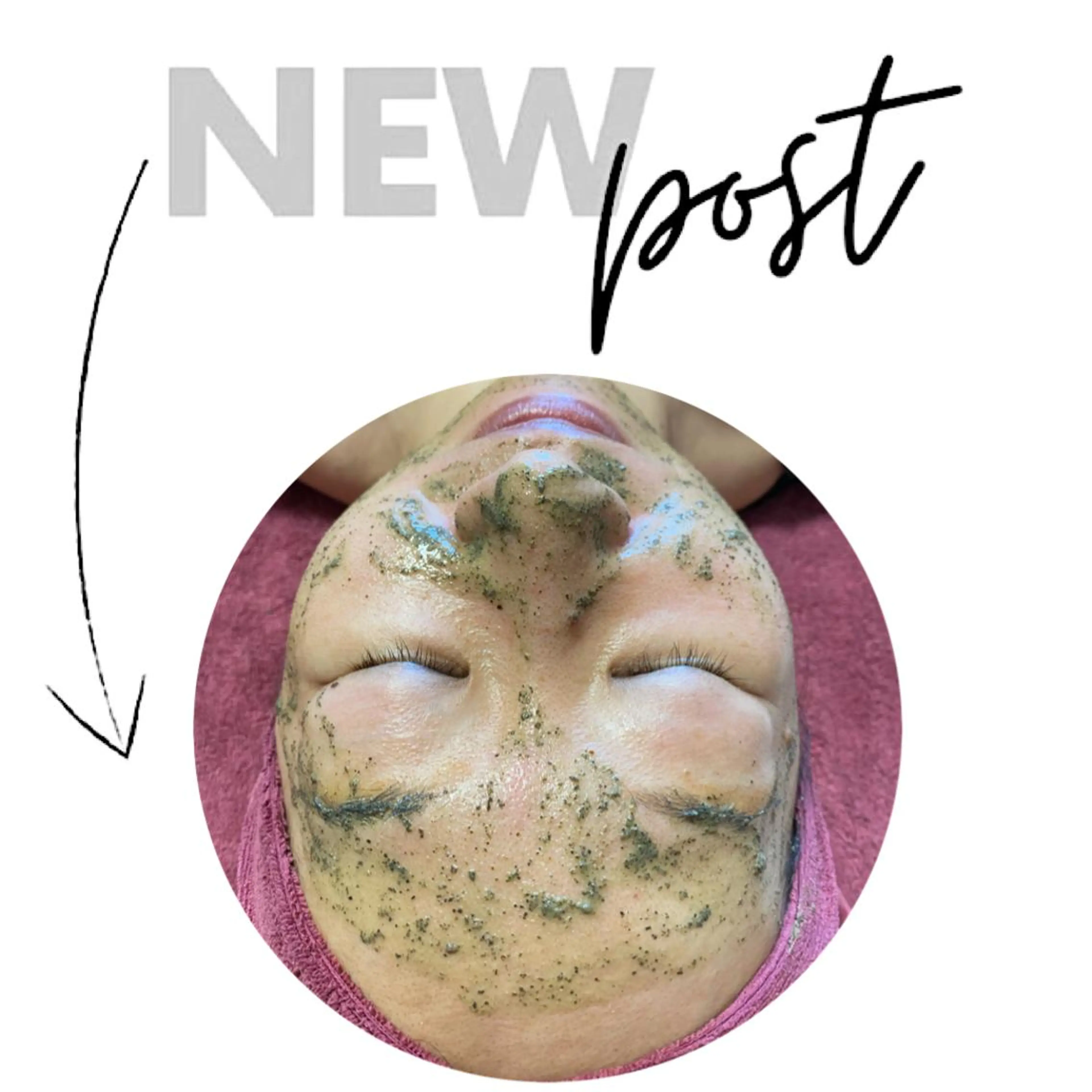 REVI取扱・肌悩み 毛穴Chalonのエステ・リラクイメージ