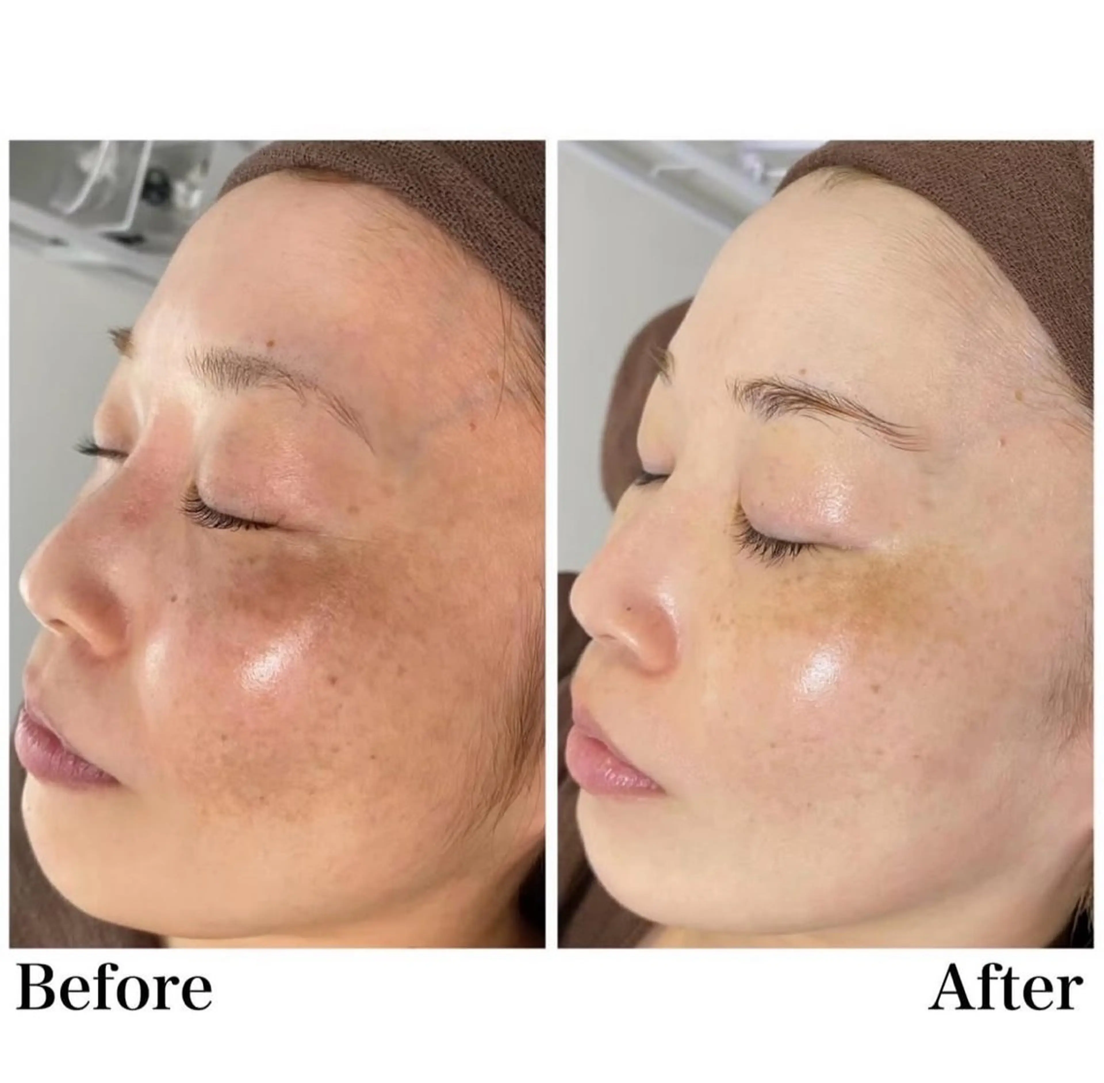 エステ Rapport ラポールのエステ・リラクイメージ