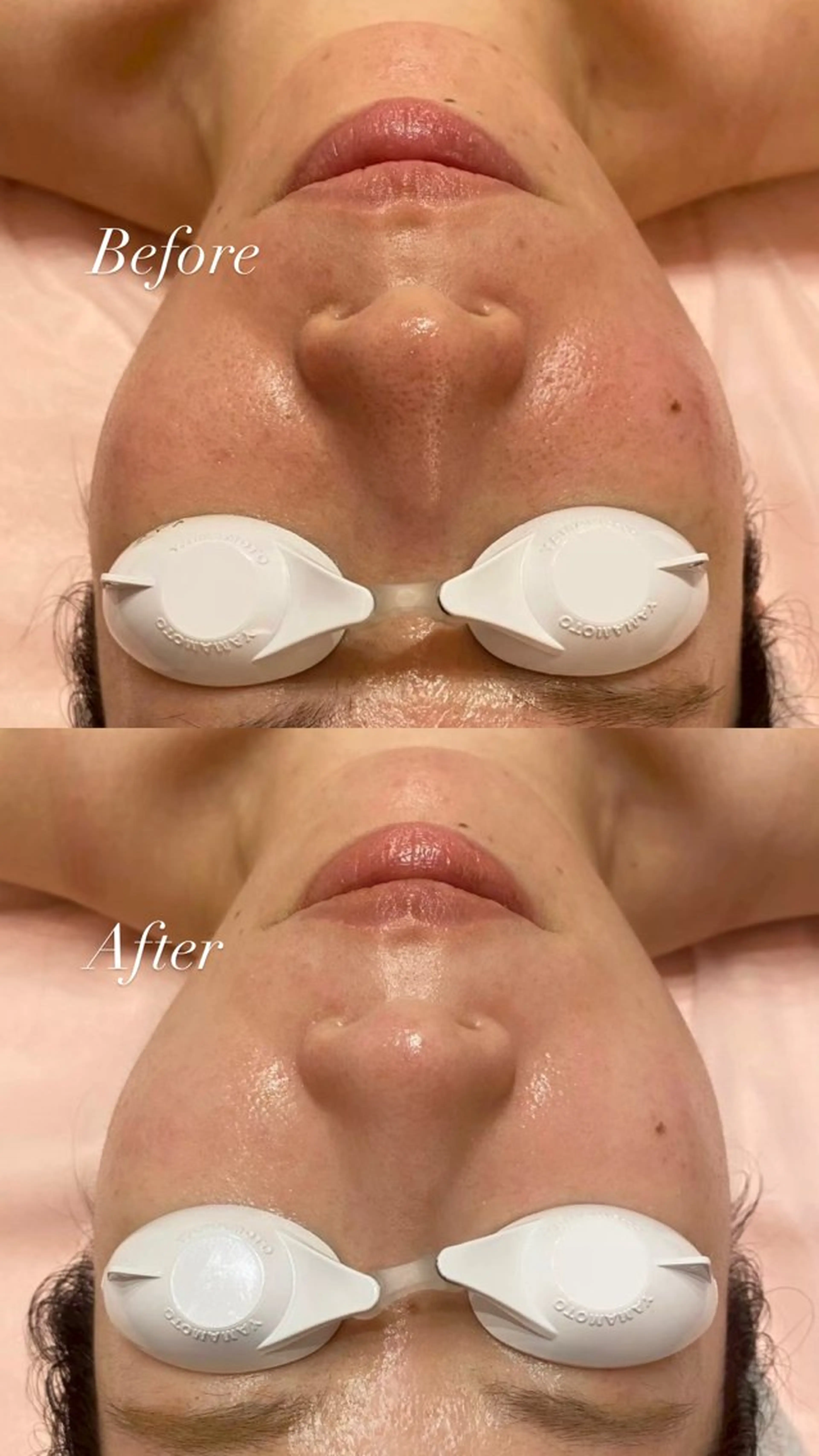 エステ SAERA yuyuのエステ・リラクイメージ