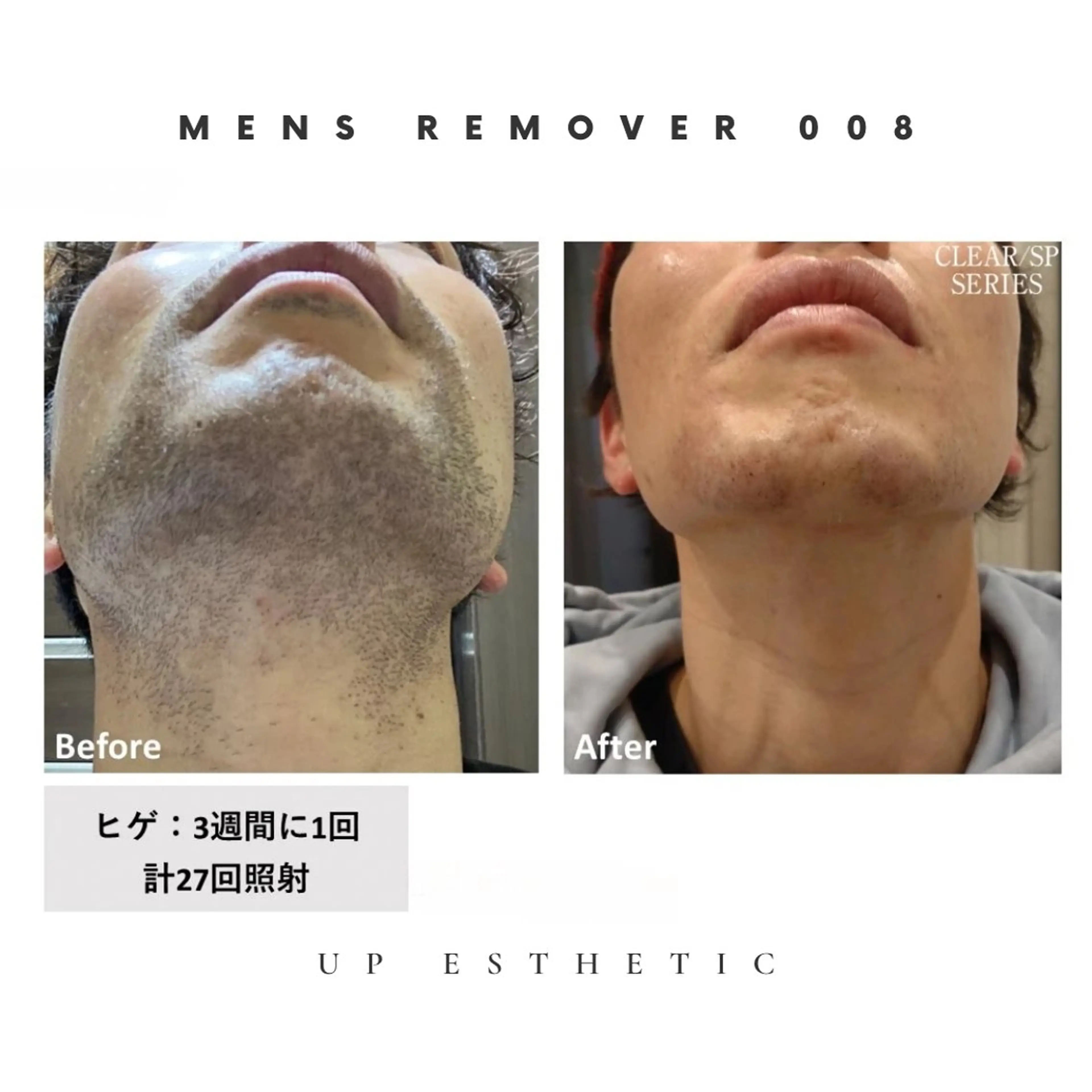 メンズ 脱毛 韓国肌管理 ウプエステティックのエステ・リラクイメージ