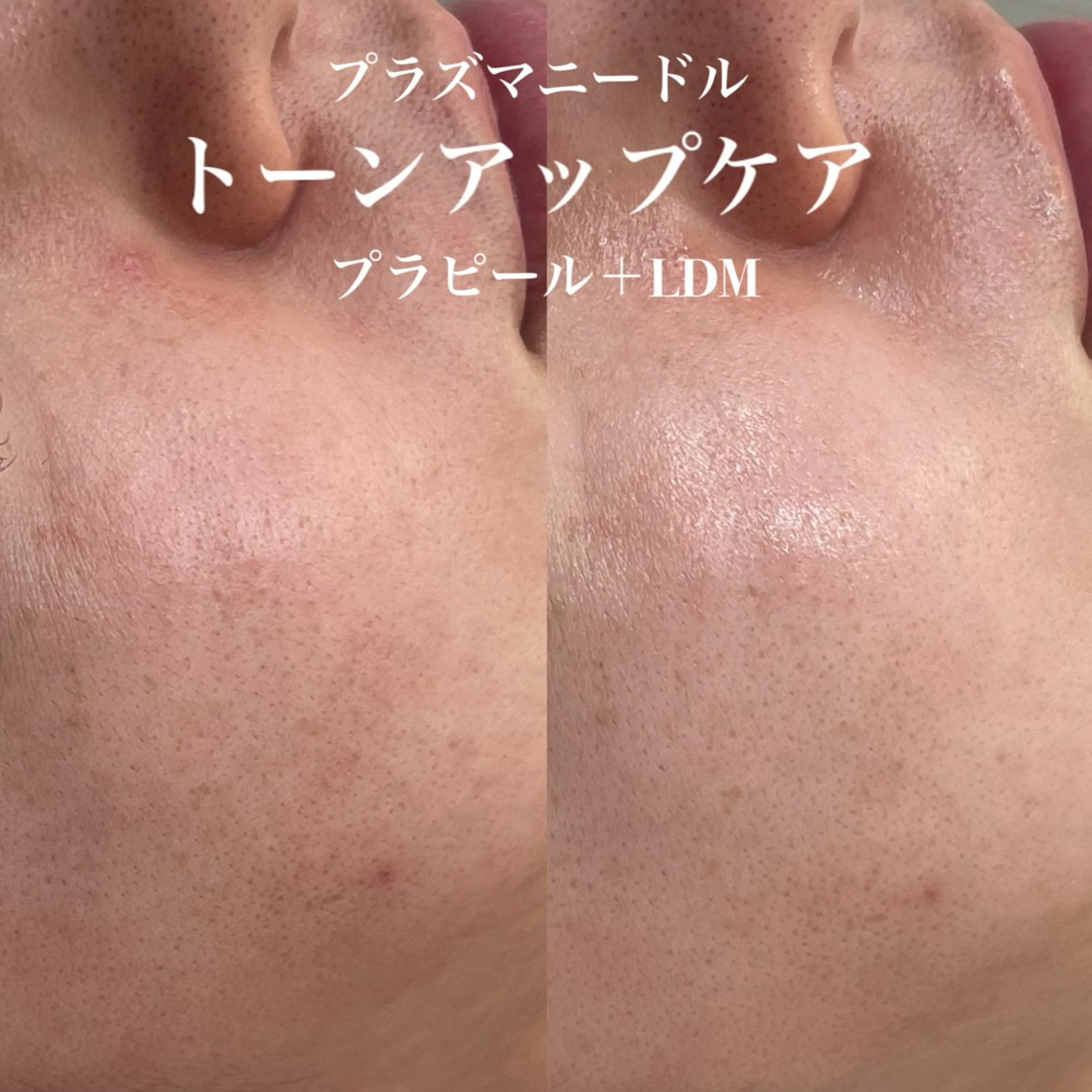 韓国肌管理&小顔 ＩＲＯＨＡのエステ・リラクイメージ