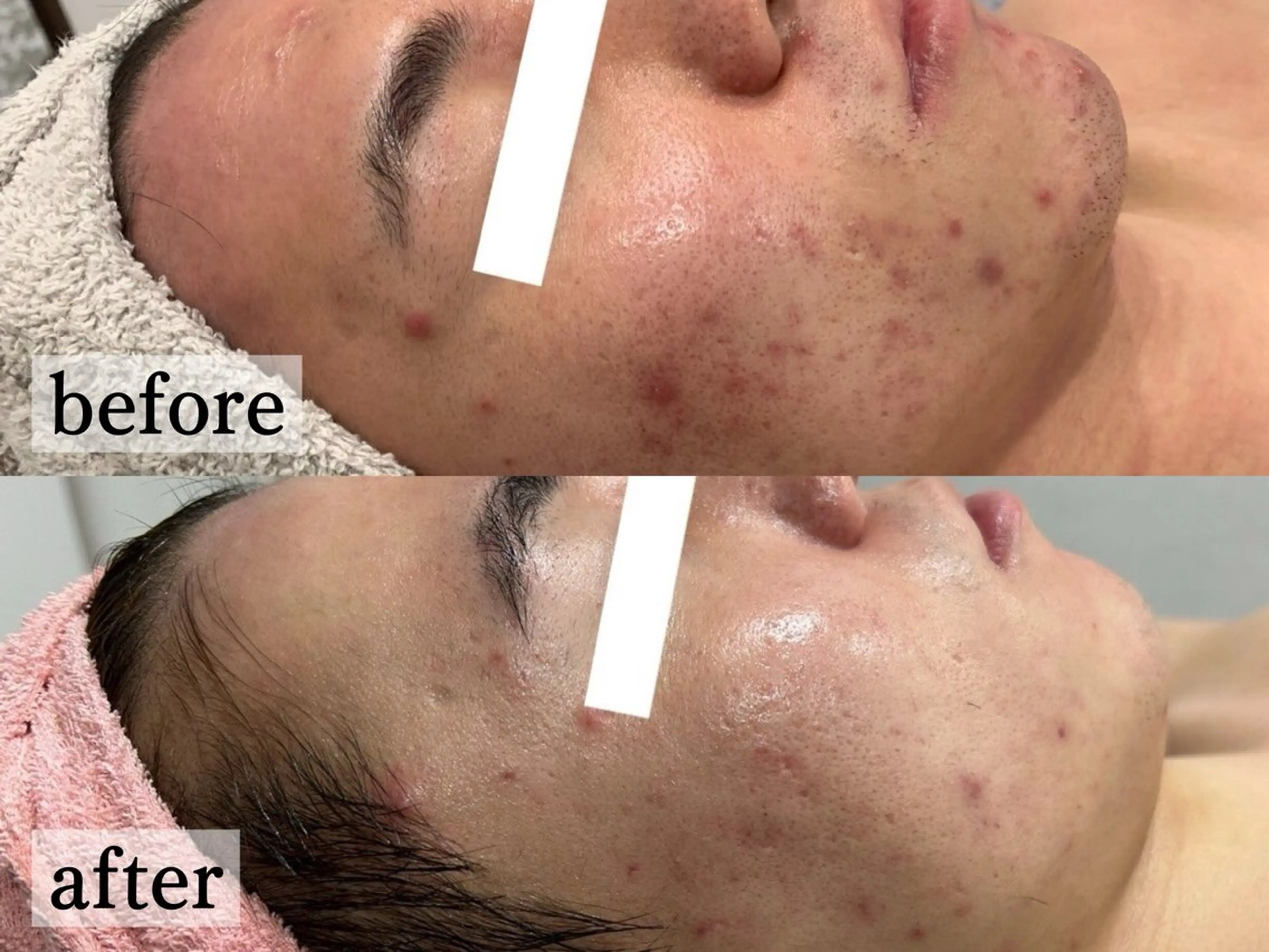 エステ フェイシャル/脱毛 ジョアアンジェ竹田のエステ・リラクイメージ