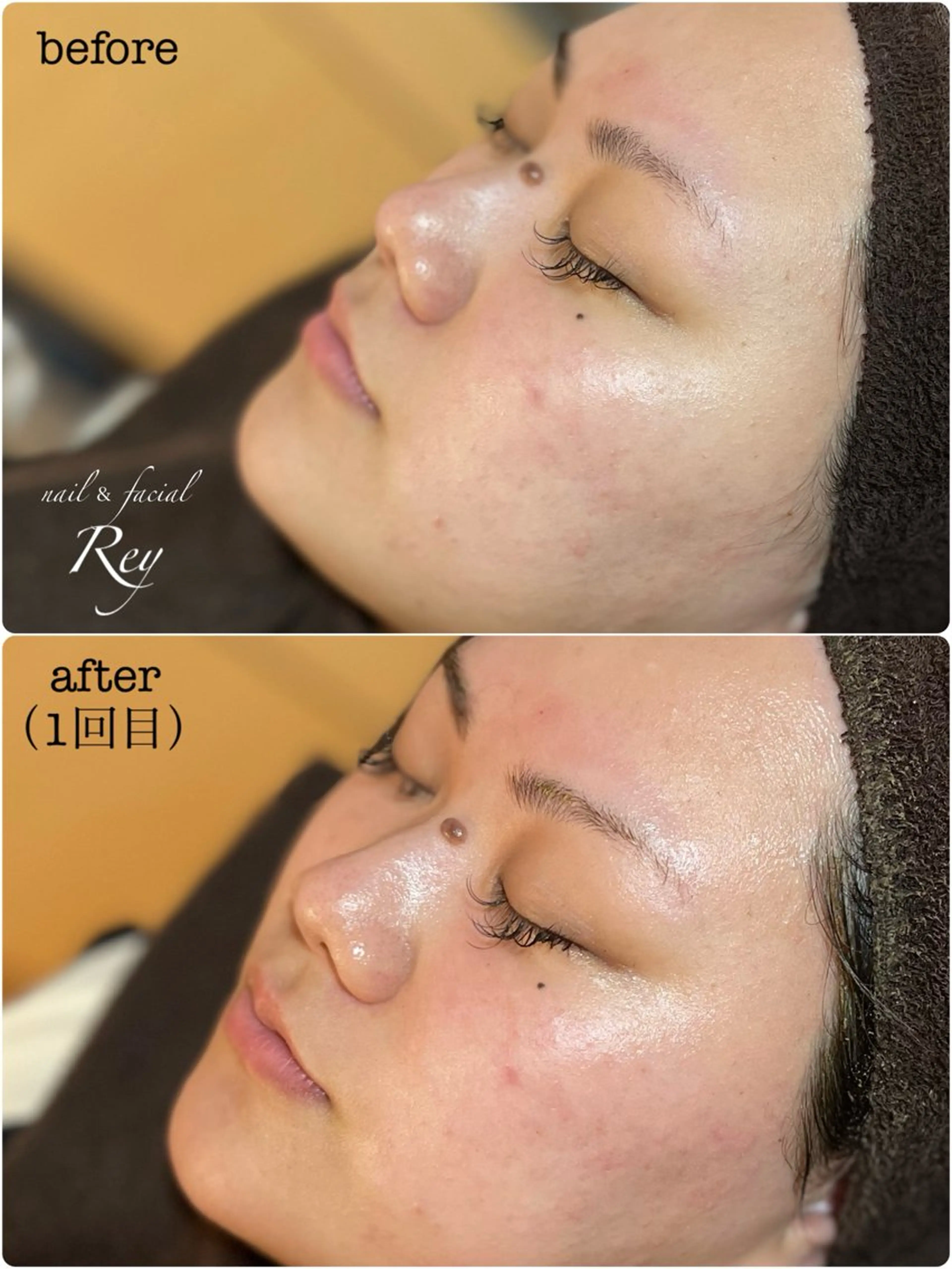 エステ R eyのネイルデザイン