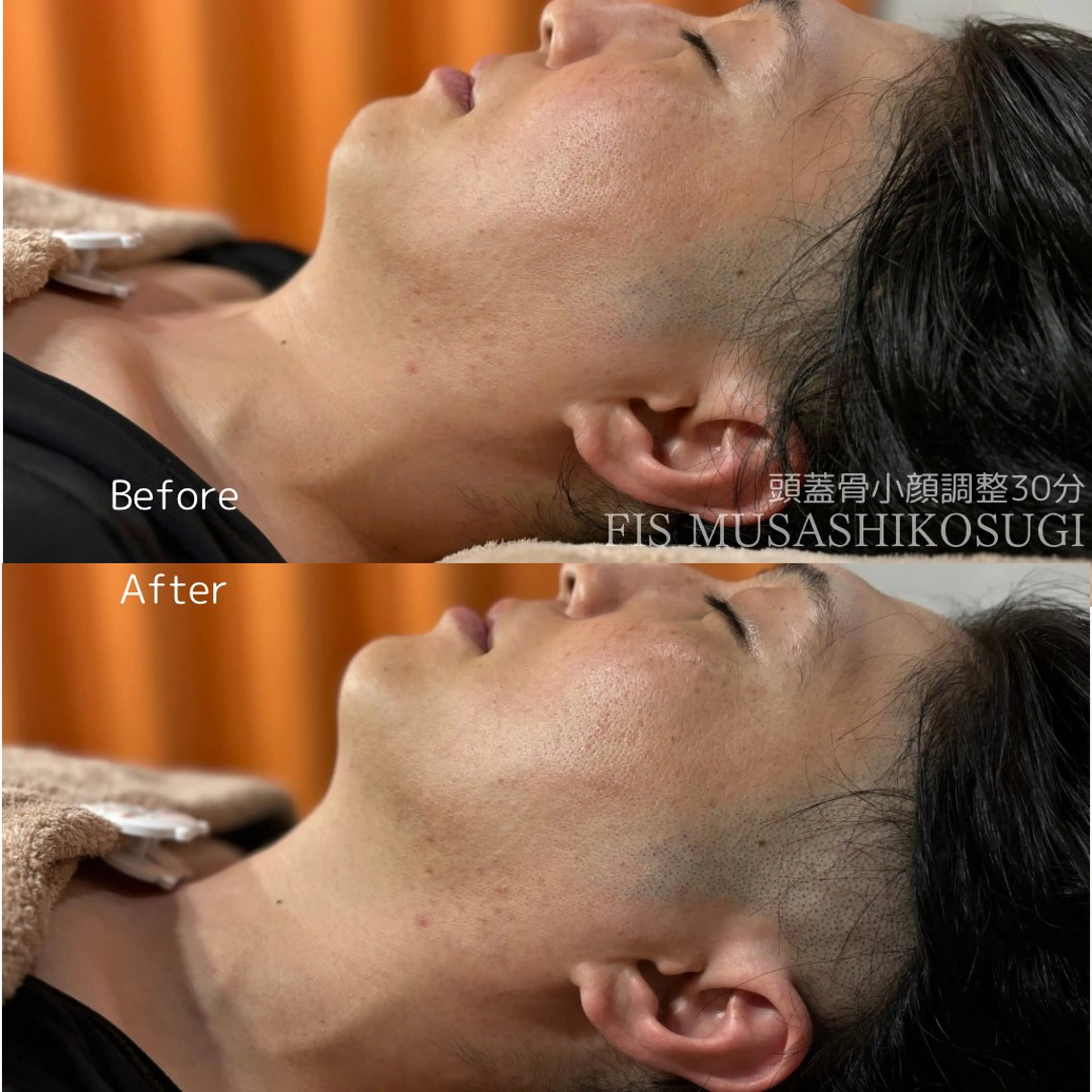 脱毛サロン FIS武蔵小杉店のエステ・リラクイメージ