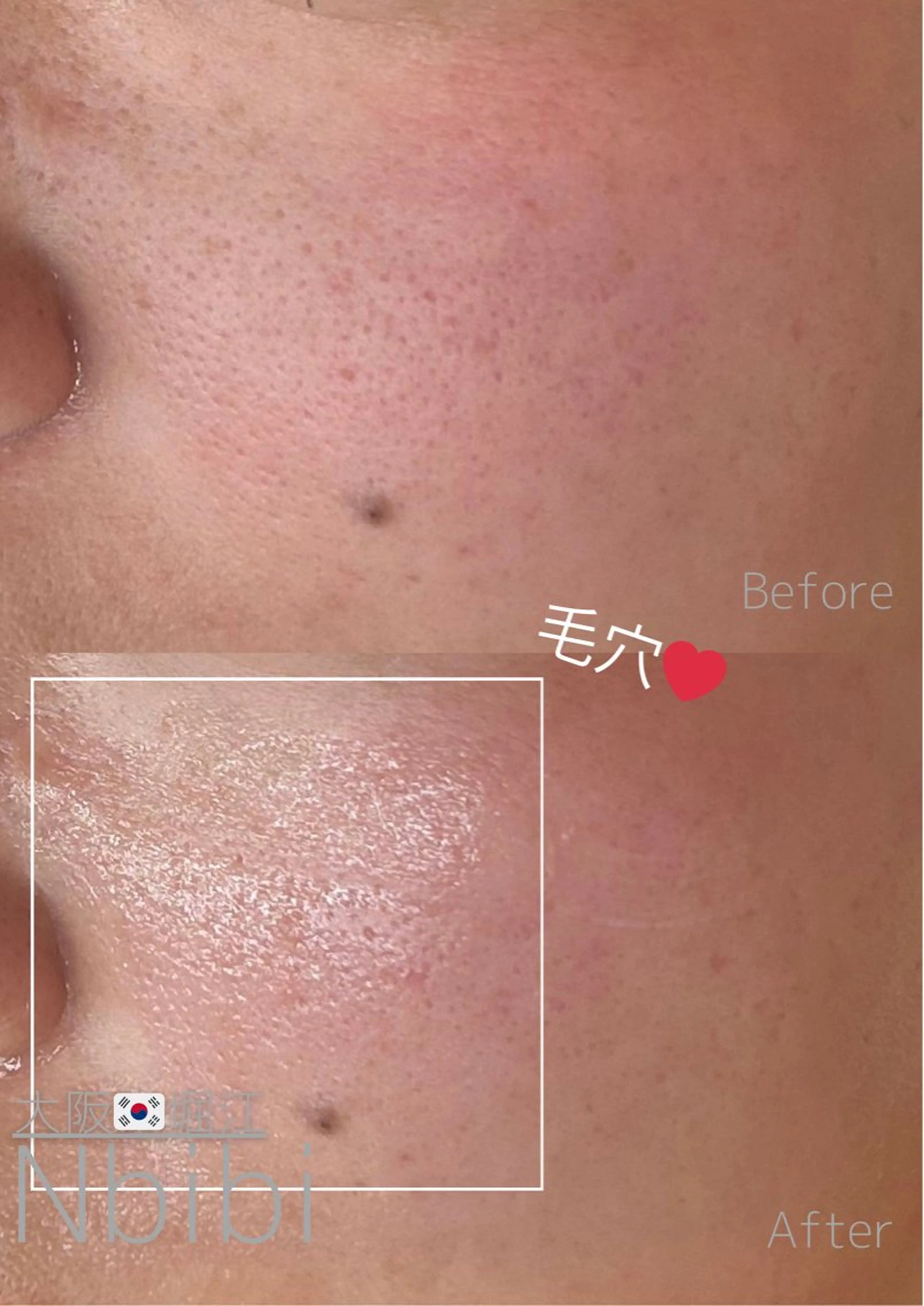 エステ 韓国🇰🇷価格 サロン_Nbibiの眉毛・アイブロウイメージ