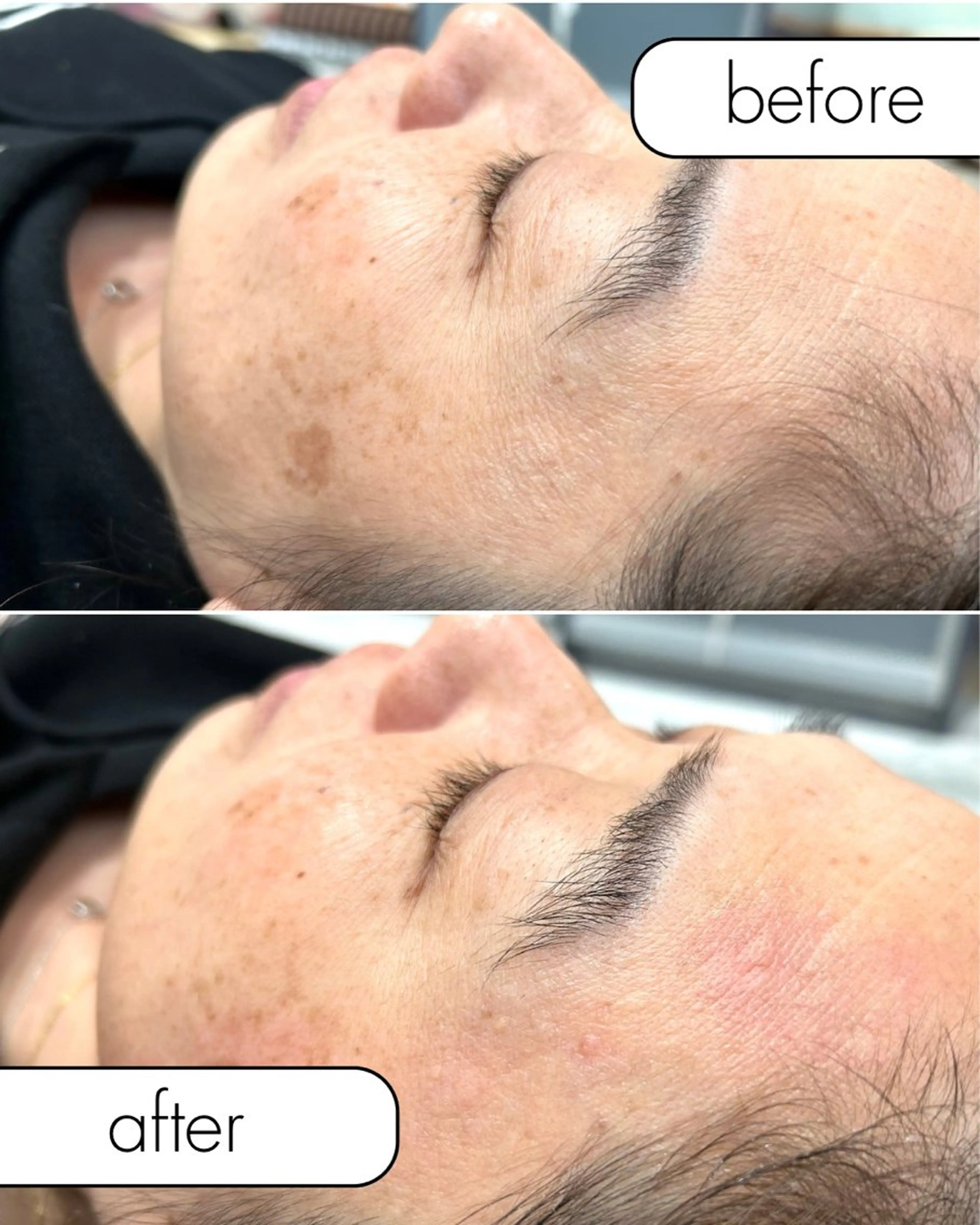 脱毛 hug me. シュガーリングサロンのエステ・リラクイメージ