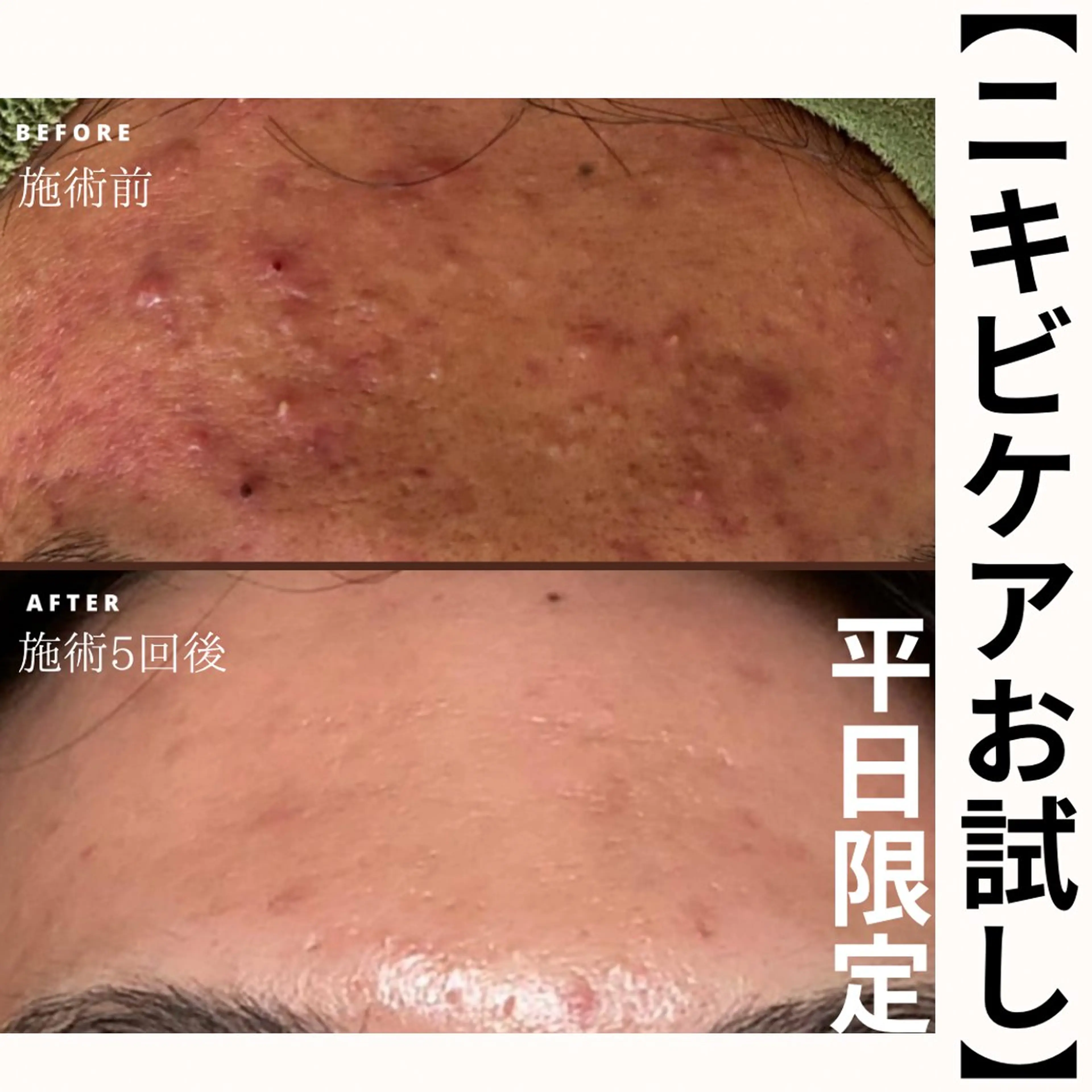 毛穴改善サロン d'Alba大阪住吉のエステ・リラクイメージ