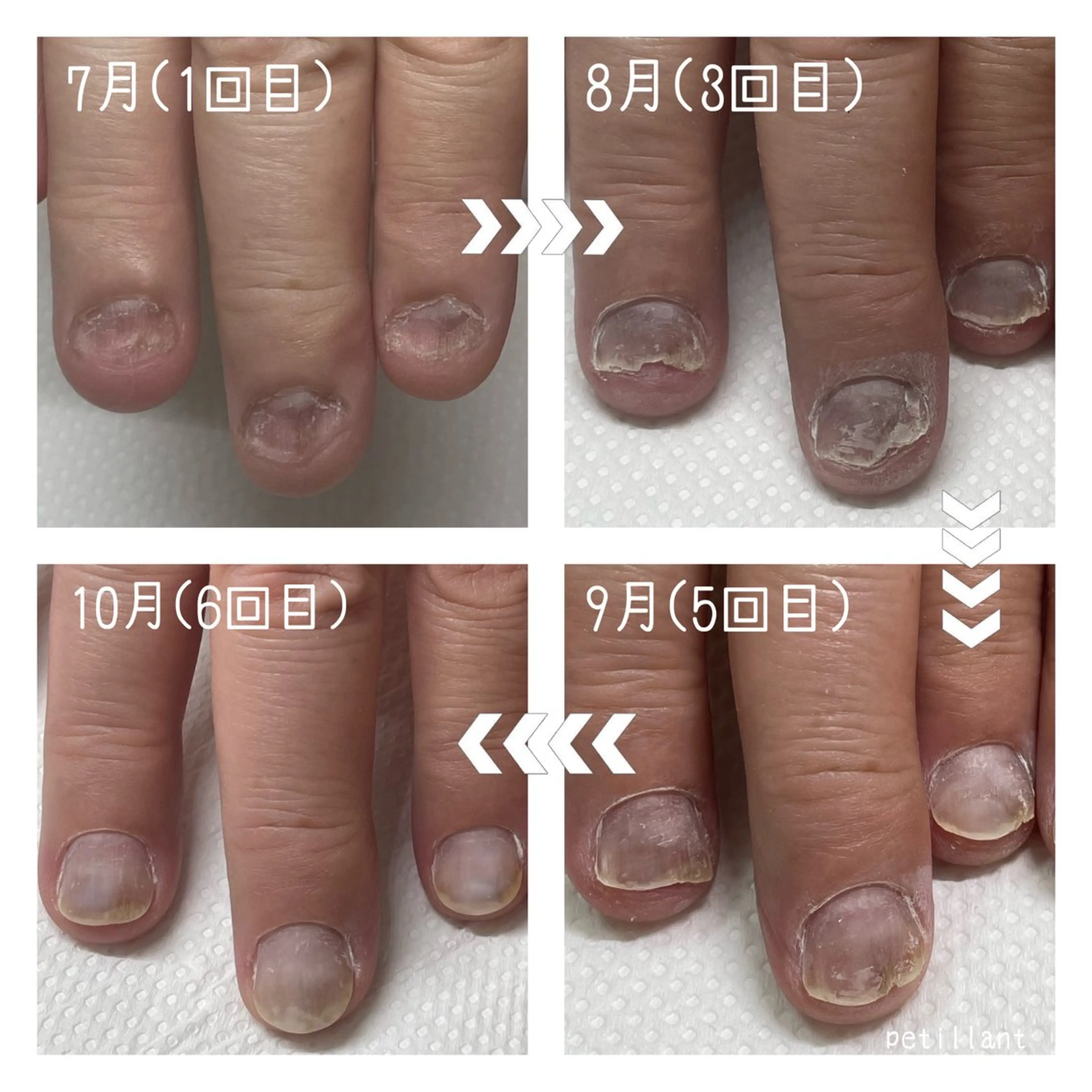 ネイル ジェルネイル nail salon petillantのネイルデザイン