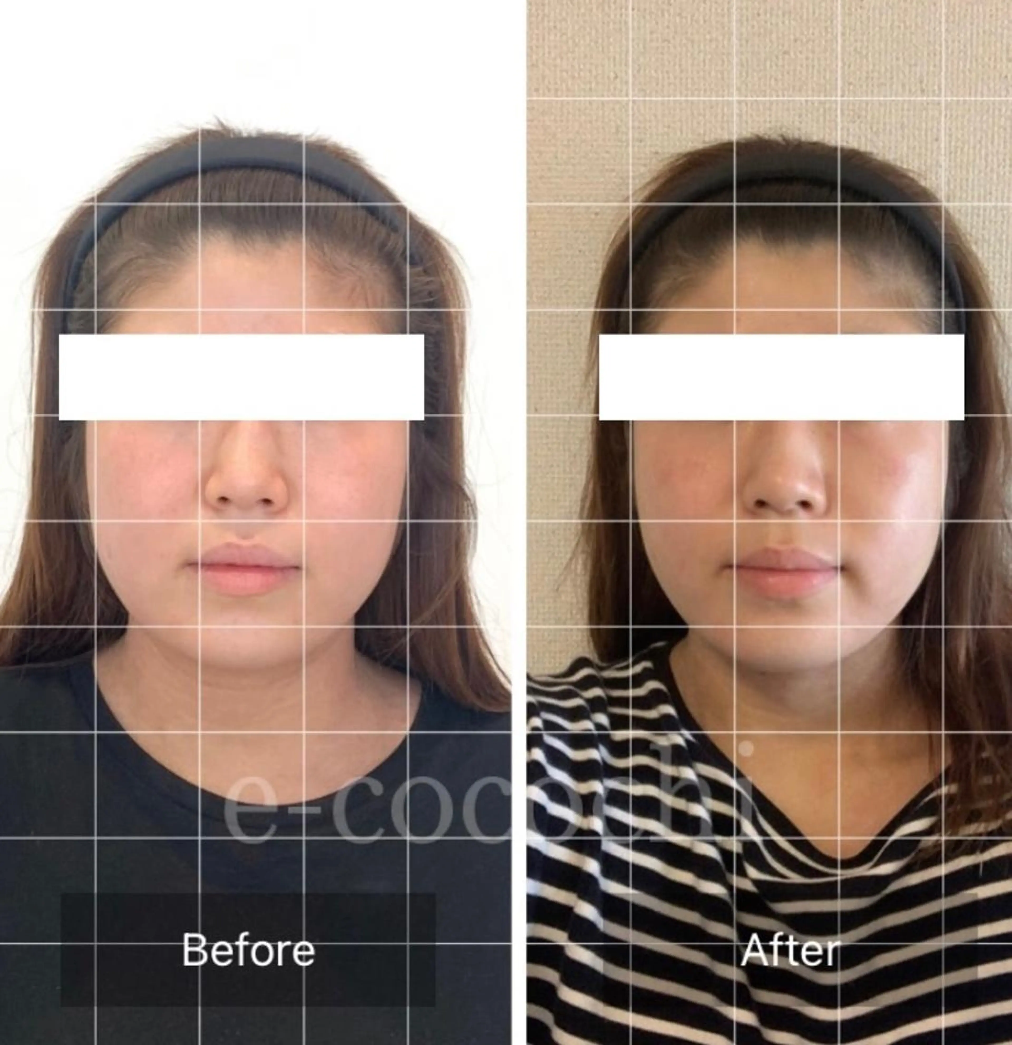 エステ リラク 小顔と ヘッドスパのお店のエステ・リラクイメージ