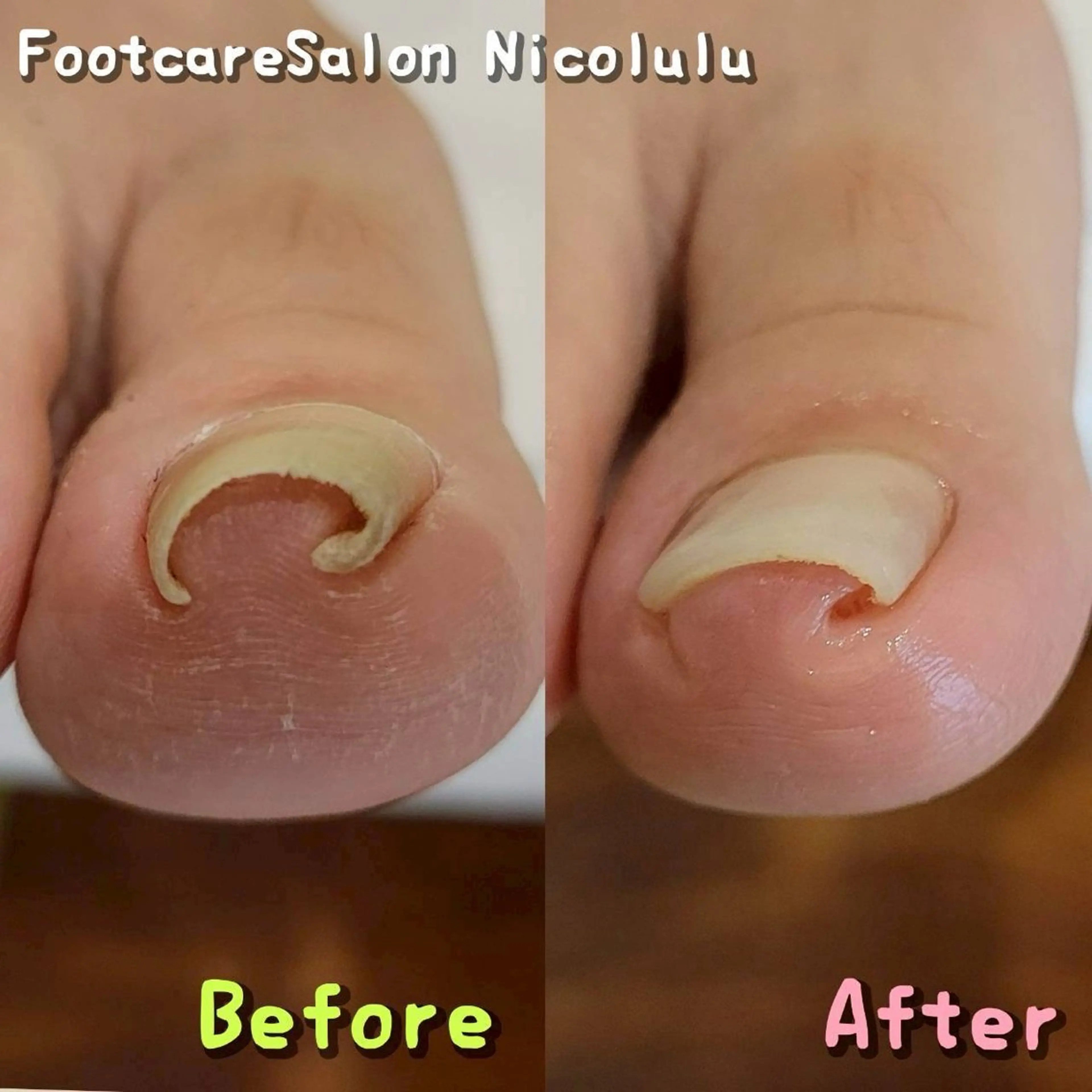 リラク 足トラブル専門 ニコルル金沢のエステ・リラクイメージ