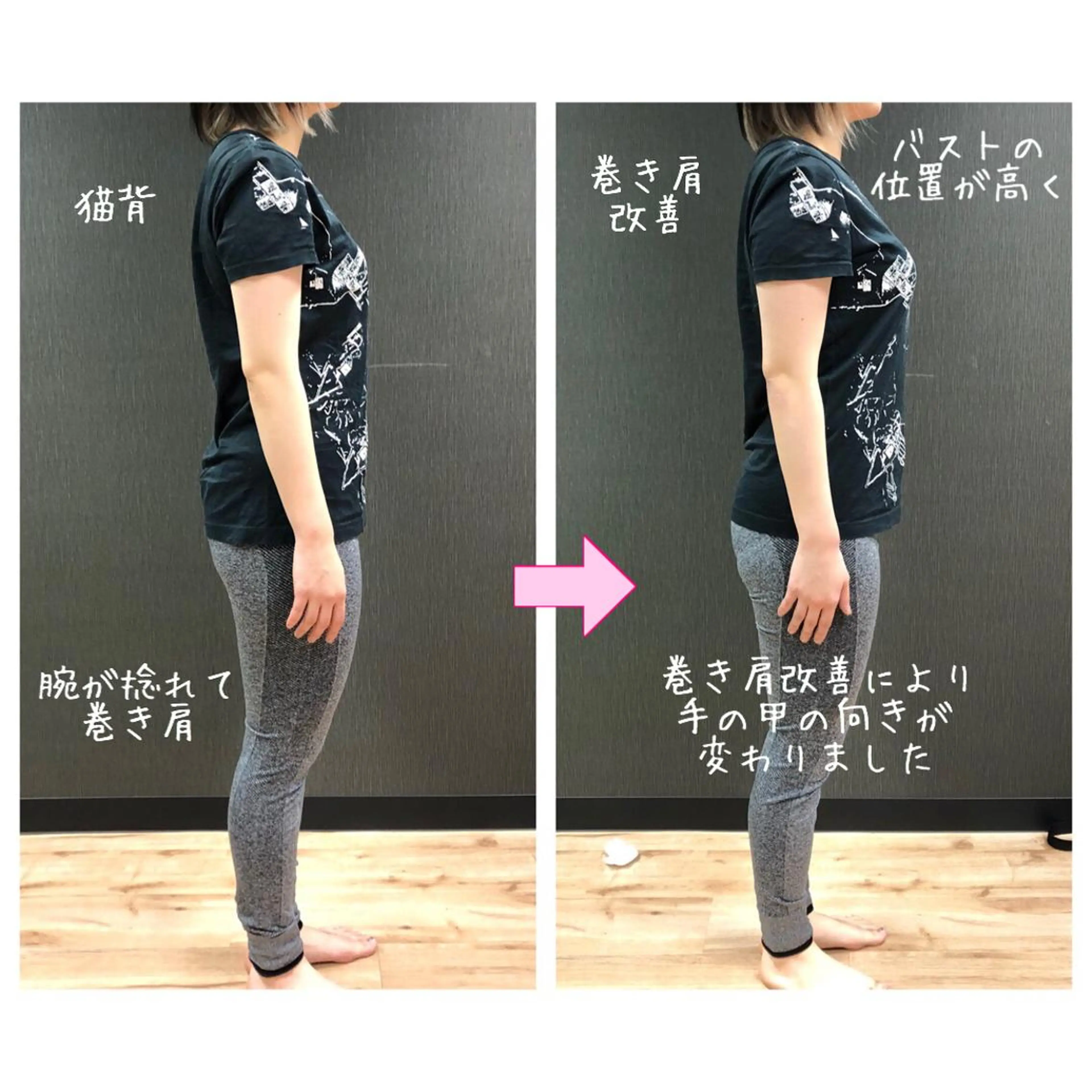 小顔モニター 募集のエステ・リラクイメージ