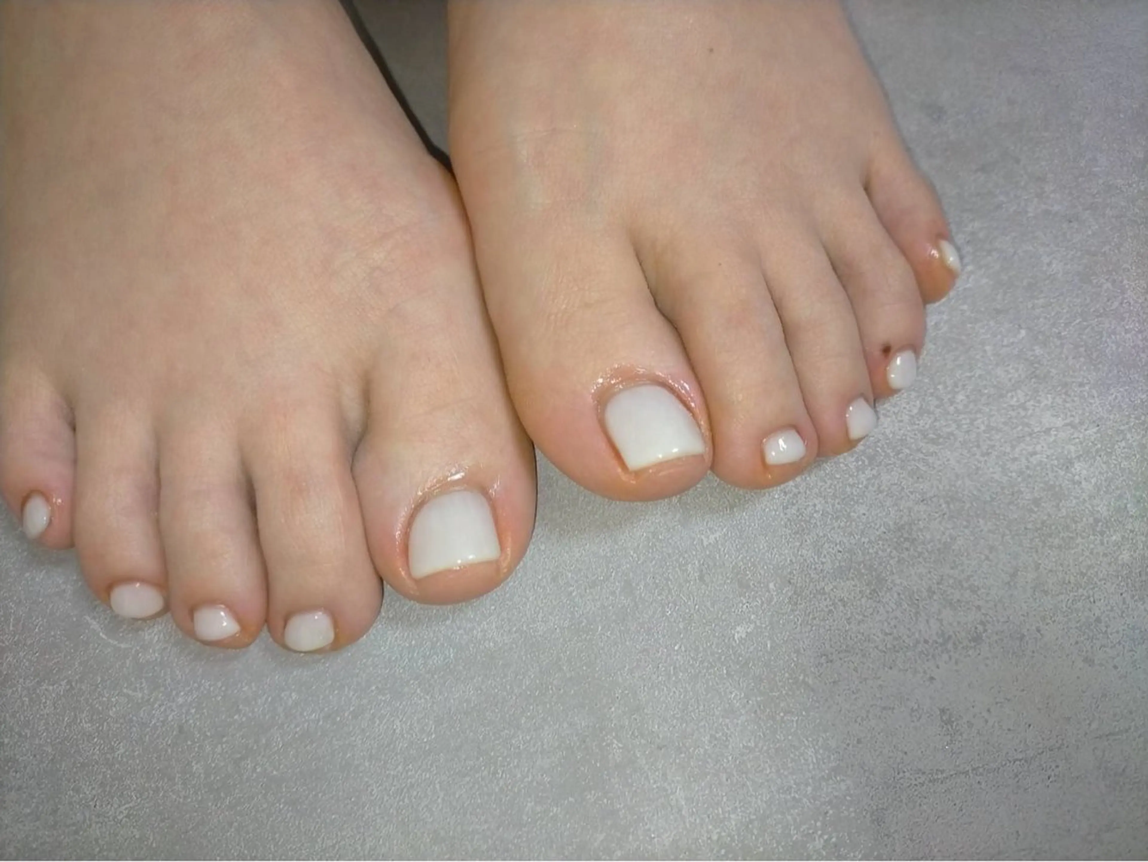 ネイル フットネイル Yu-a 🌻 ルカのネイルデザイン