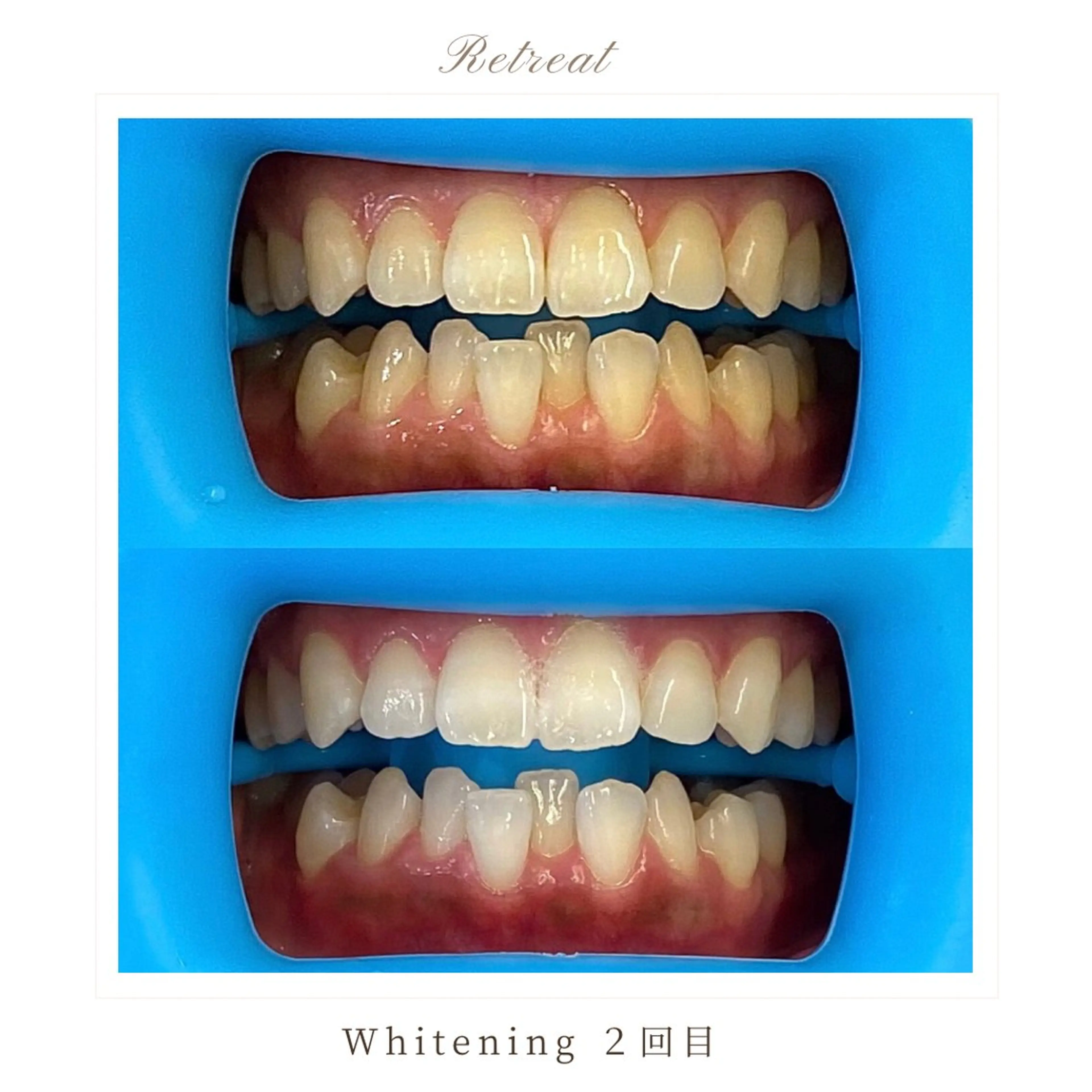 Retreatリトリート所属・歯科医院提携 Retreatのエステ・リラクイメージ