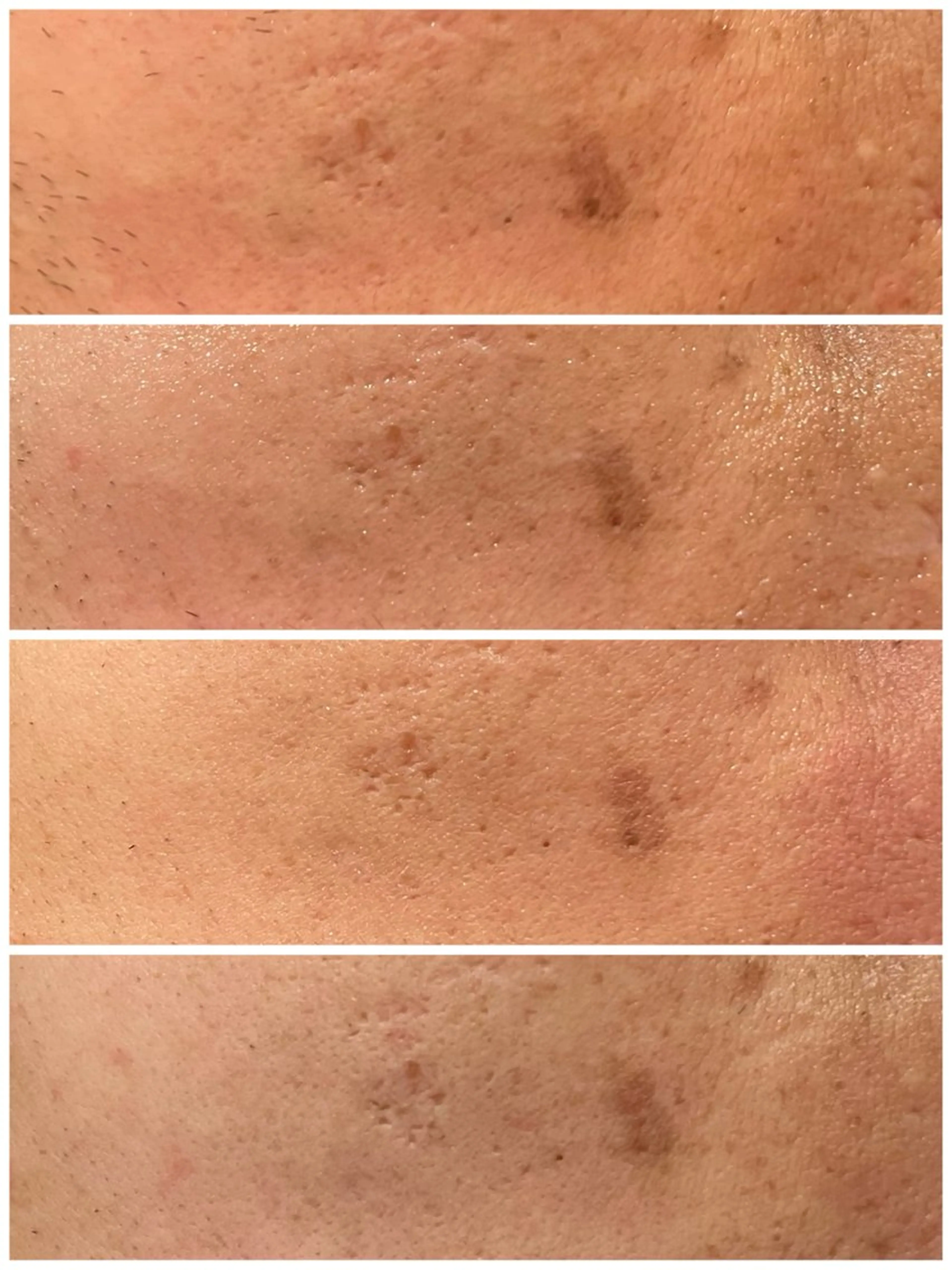 小顔コルギ ☆表参道/外苑前のエステ・リラクイメージ