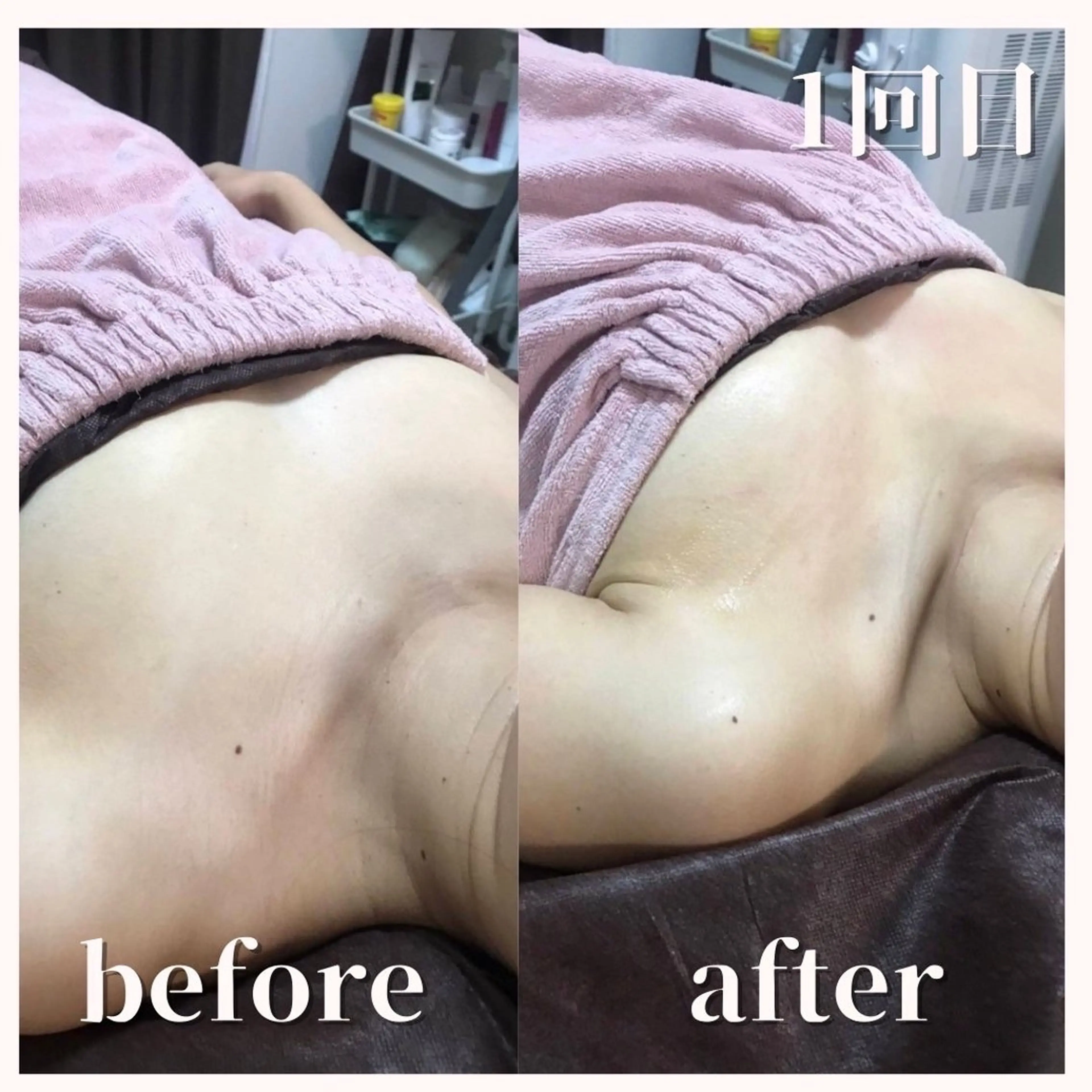 エステ 切らない脂肪吸引🔥 Neroliまりこのエステ・リラクイメージ