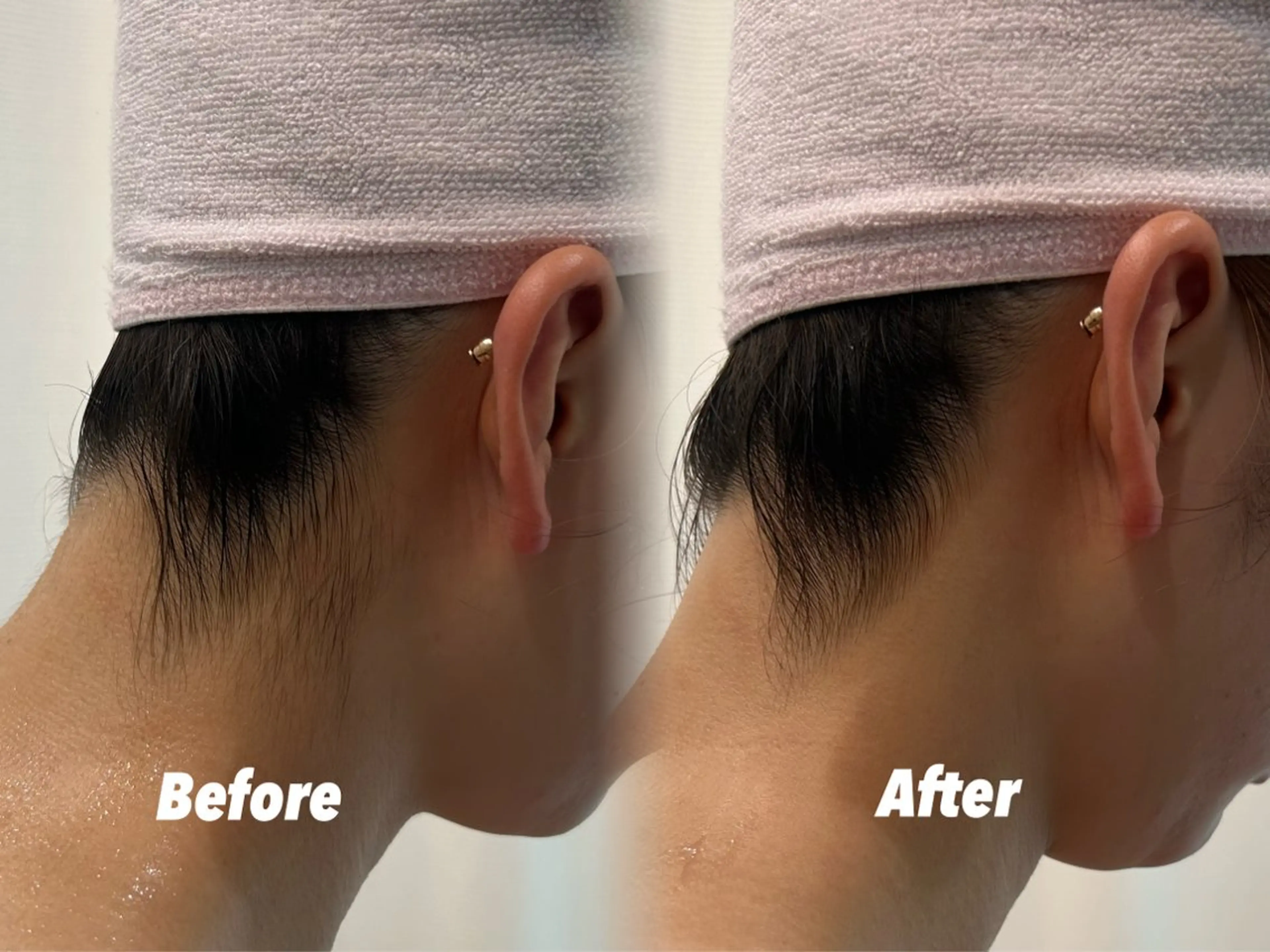 その他 🫧美しい素肌へ🫧 今成柚乃のその他イメージ