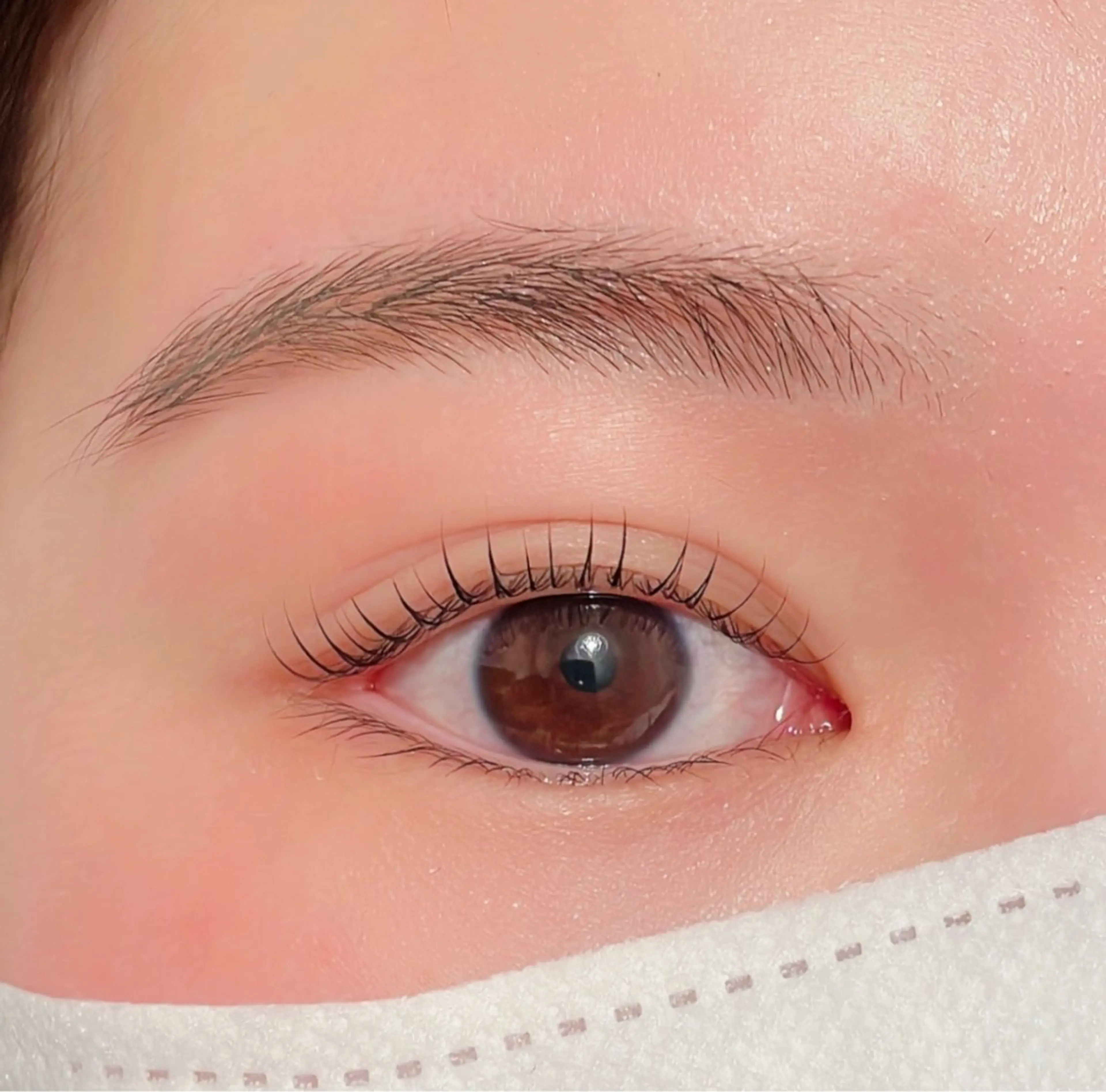 マツエク・マツパ 【医療提携】脱毛 小顔ハーブピーリングのエステ・リラクイメージ