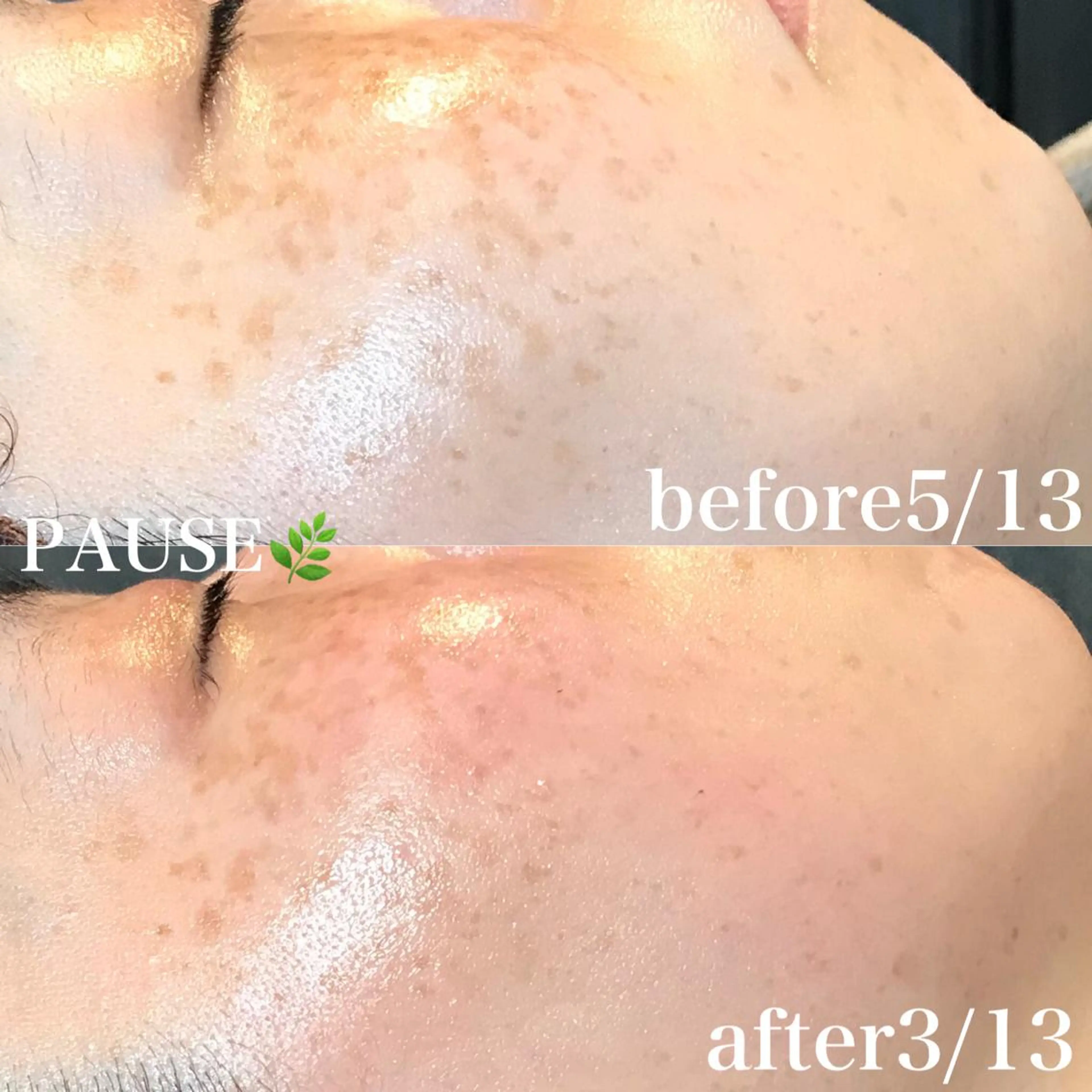 エステ 浜野 恵美のエステ・リラクイメージ