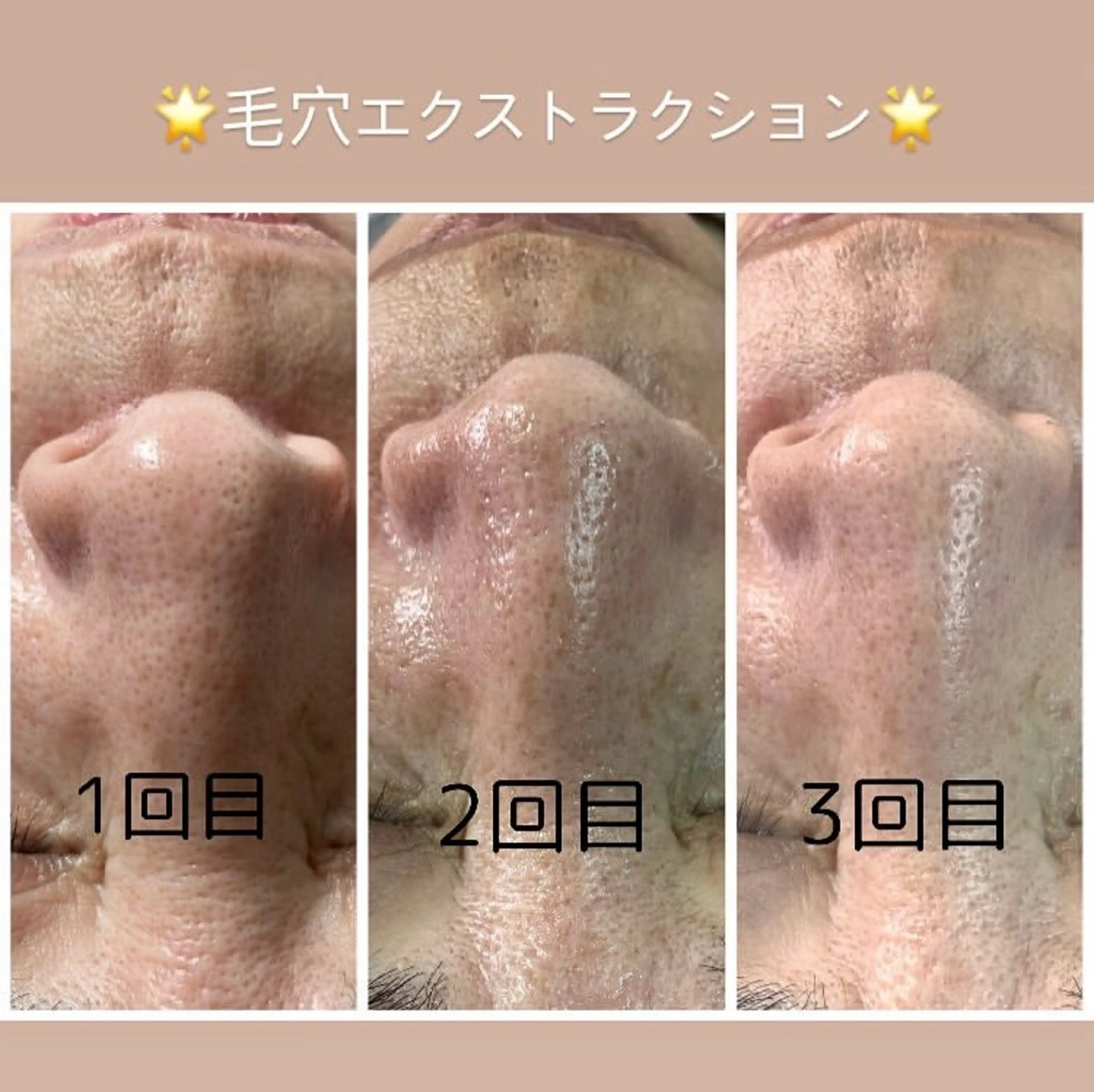 Purnama あきのネイルデザイン