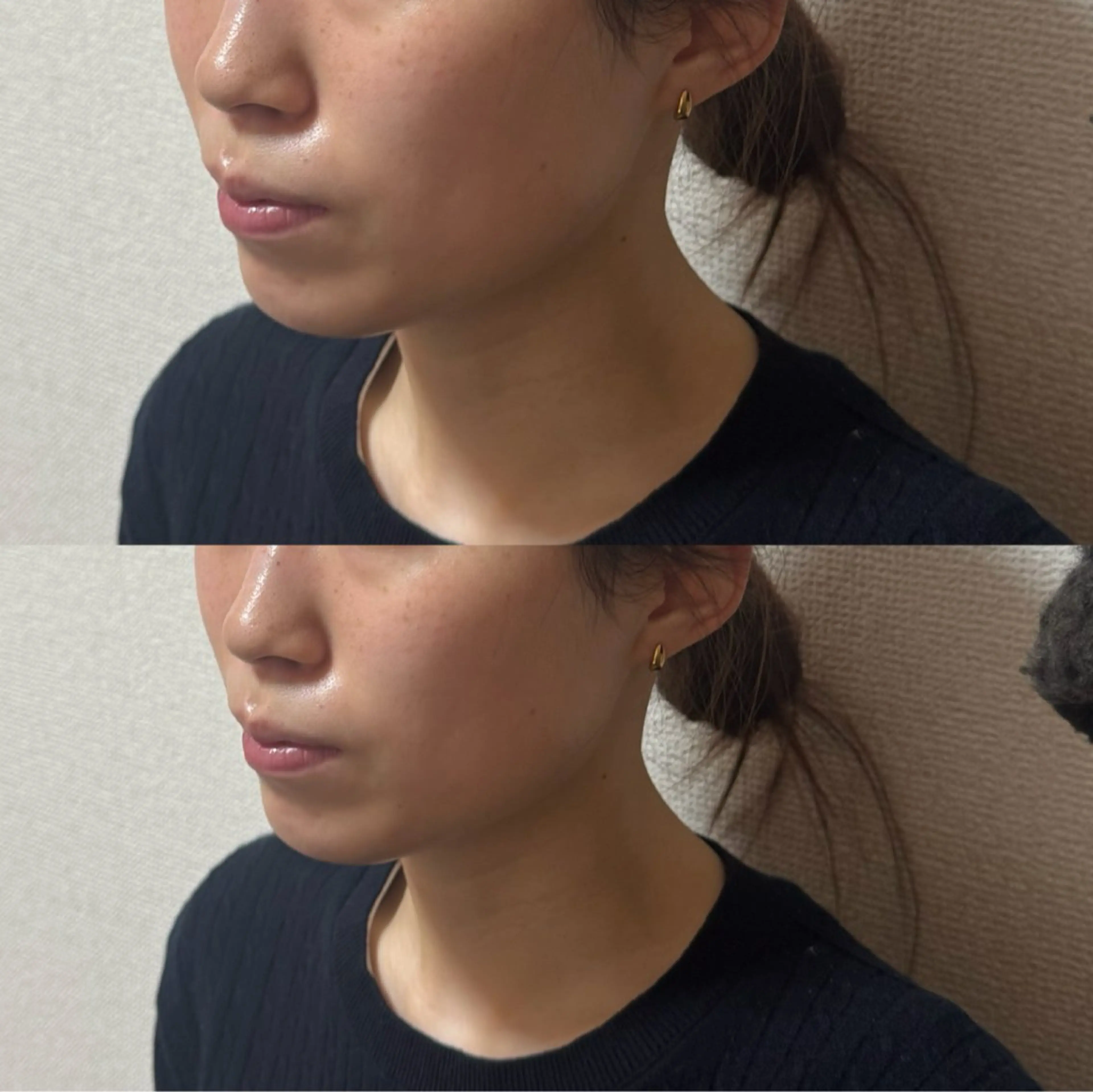 Amaranth所属・Lupinus 小顔矯正のエステ・リラクイメージ