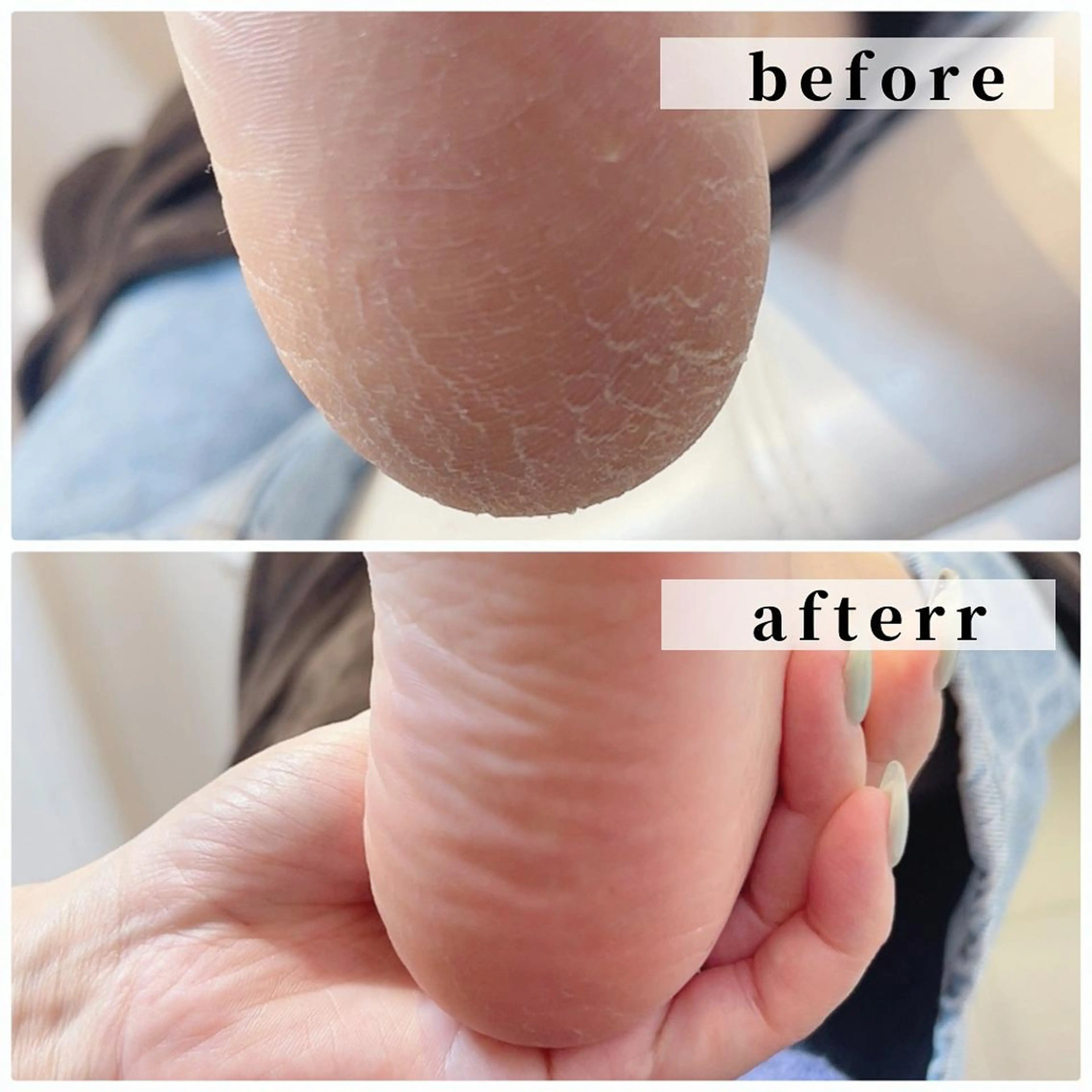 足裏つるつるコース❤️FOOTワンカラー+足の角質ケア🦶🏻✨初回¥10000 他店オフ初回無料🌸の写真