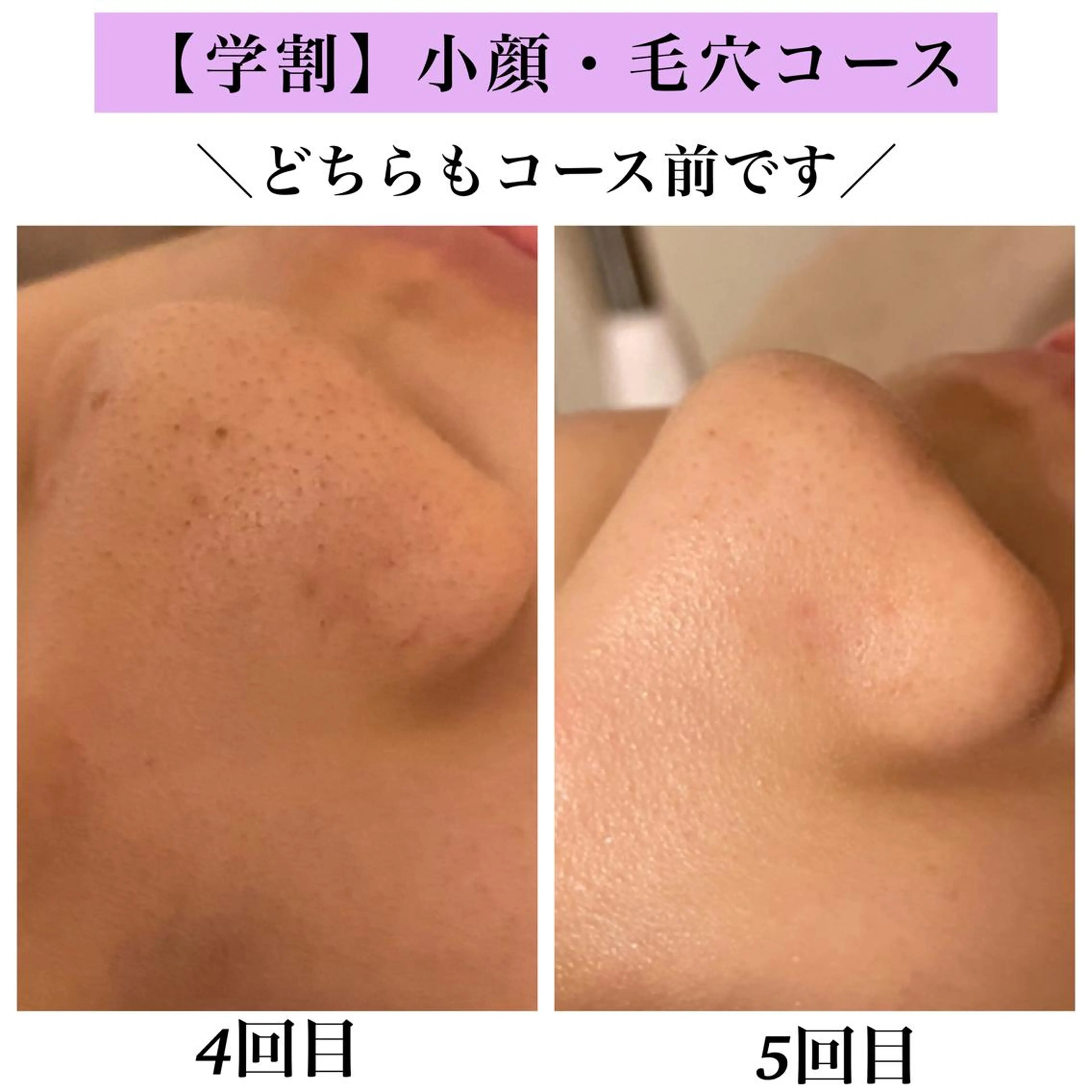 Bellesthe （ベルエステ）のエステ・リラクイメージ