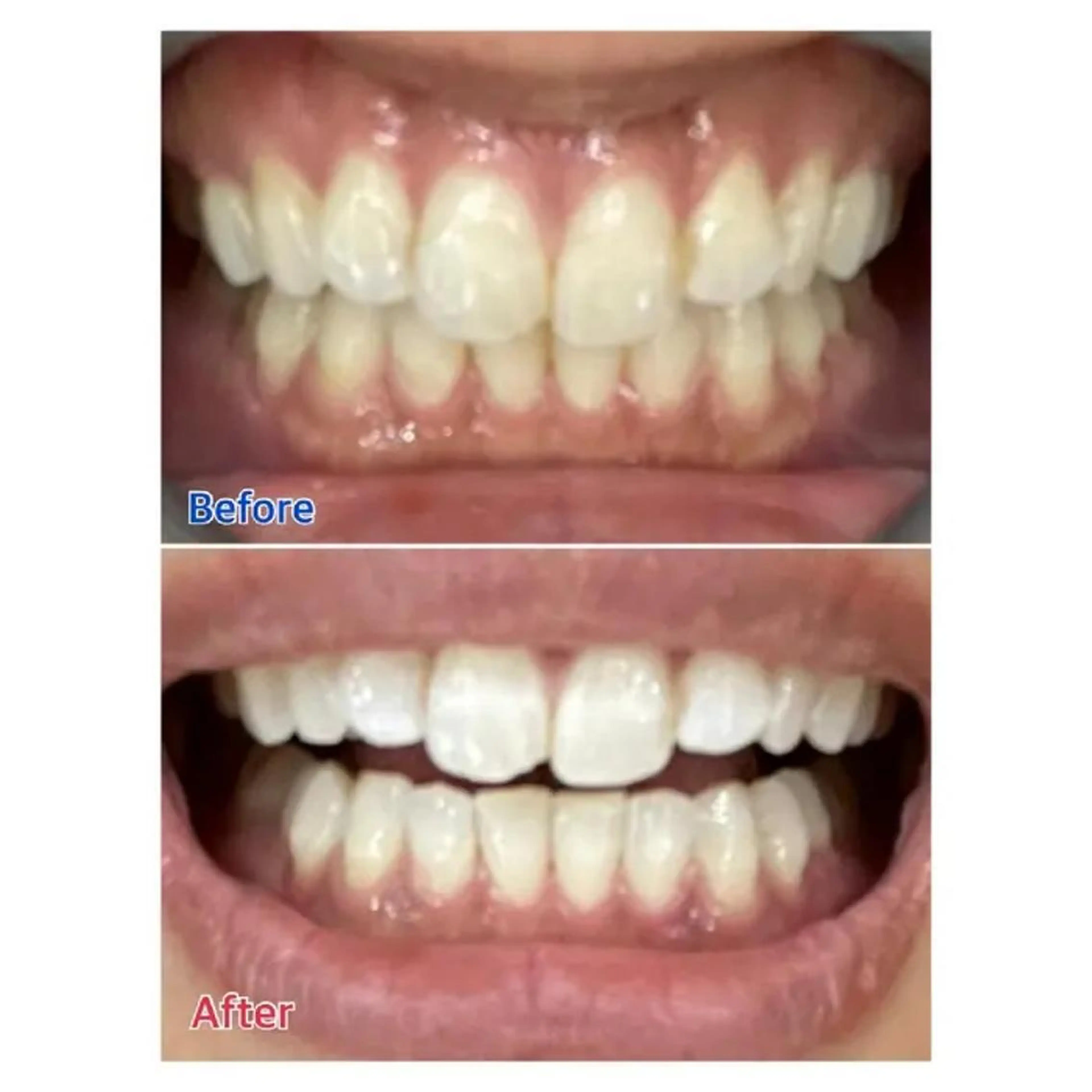 M渋谷 ホワイトニングのエステ・リラクイメージ