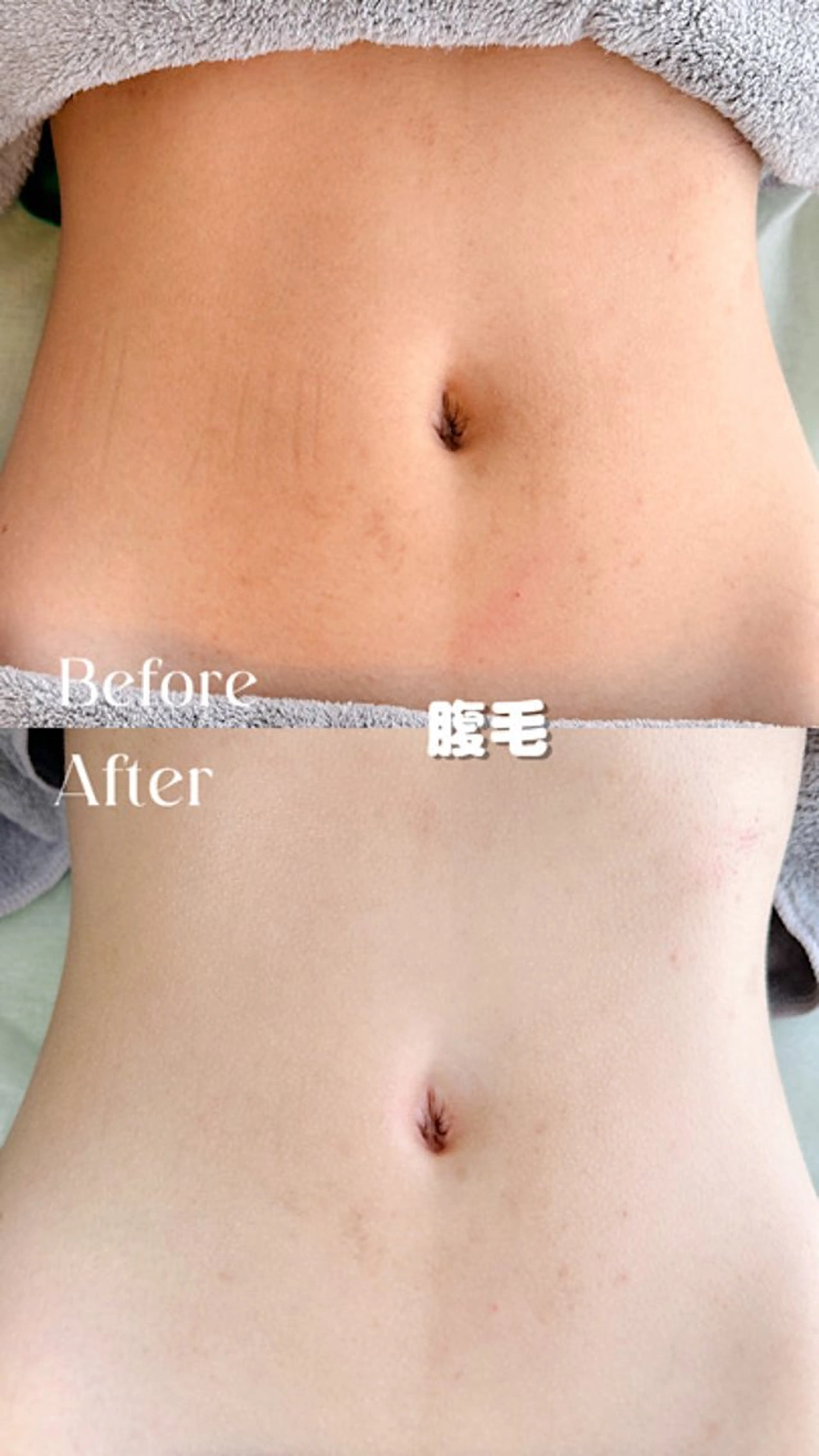 Hitomi シュガーリング豊橋のその他イメージ