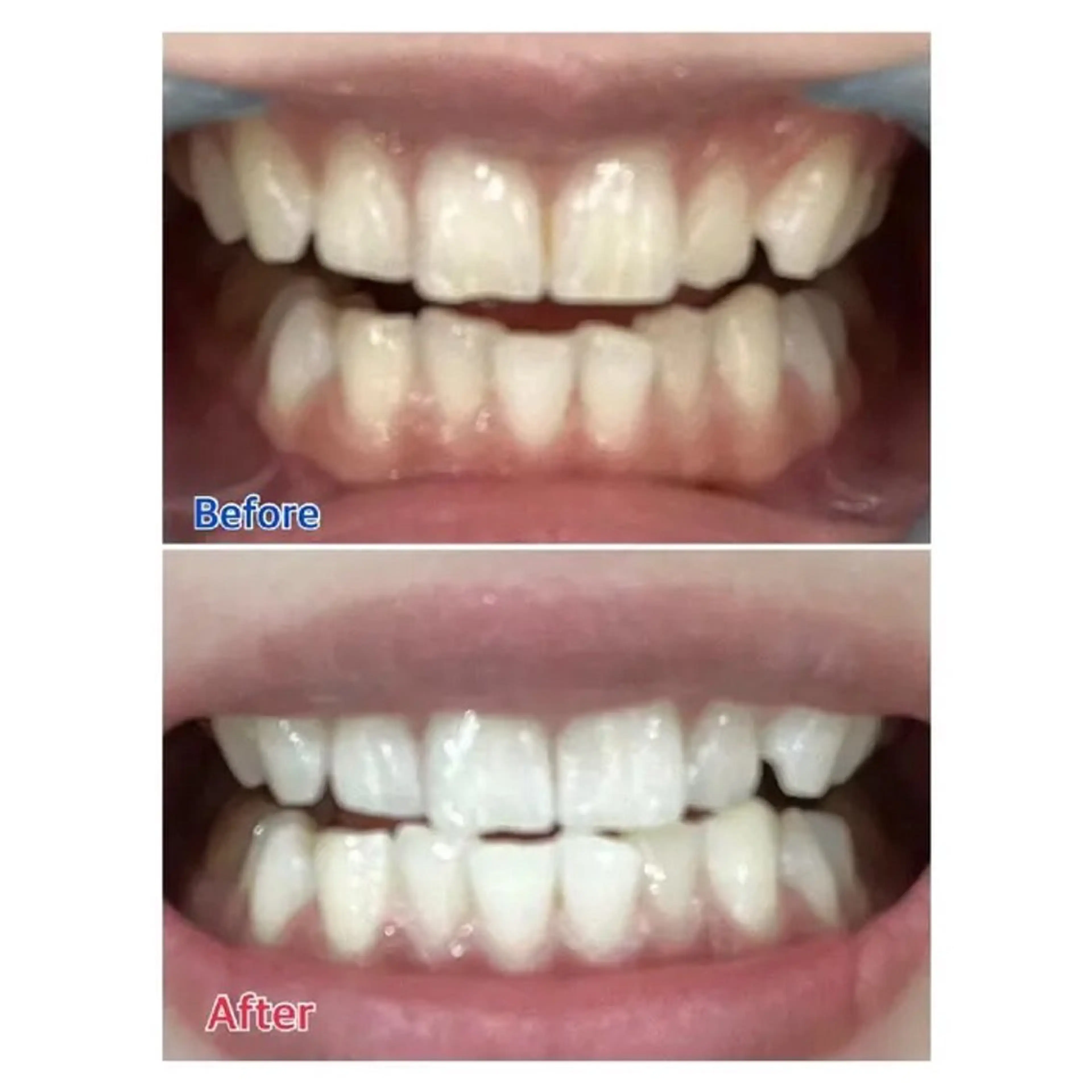 Ｍ渋谷 ホワイトニングのエステ・リラクイメージ