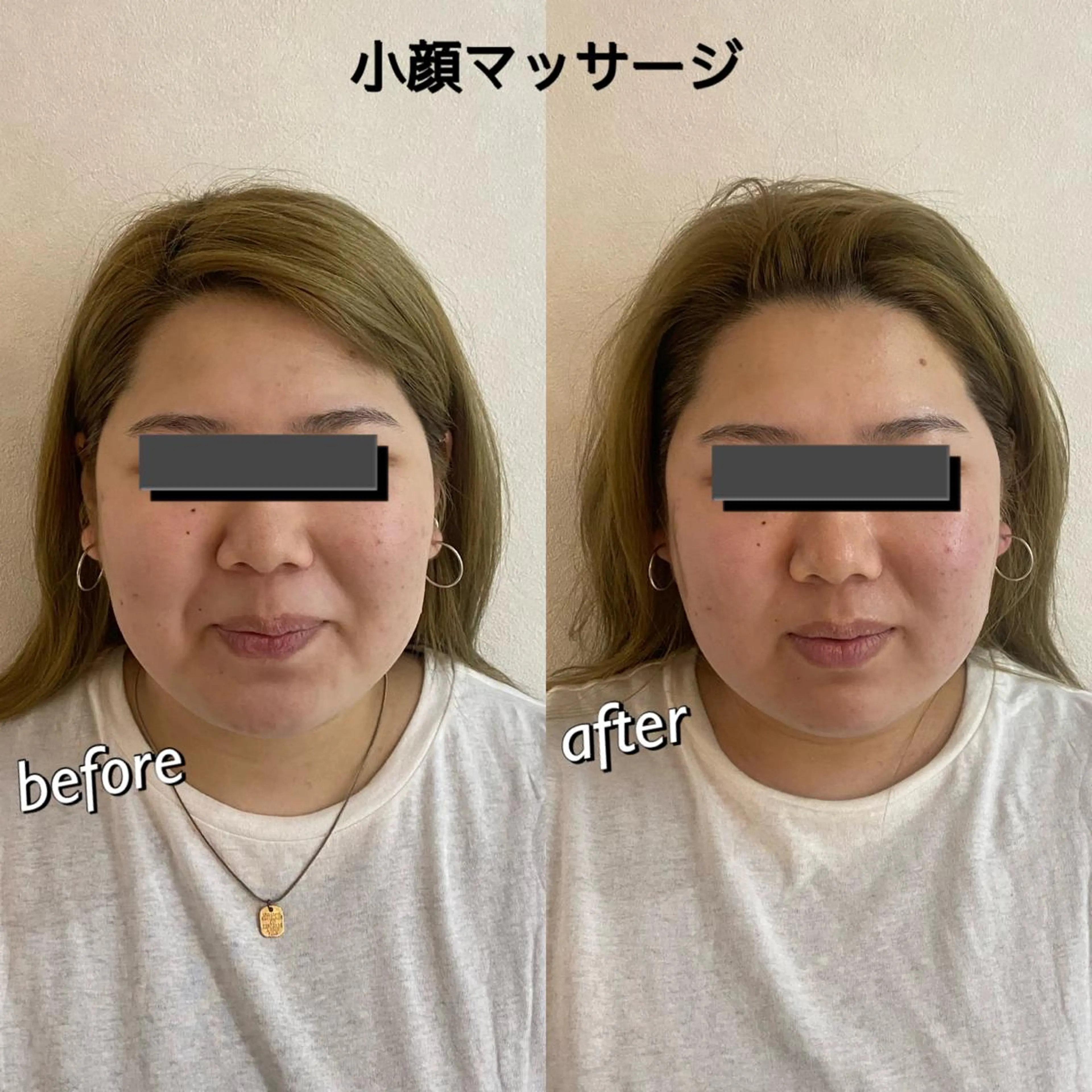 うなじ脱毛/美肌脱毛 LABELのエステ・リラクイメージ