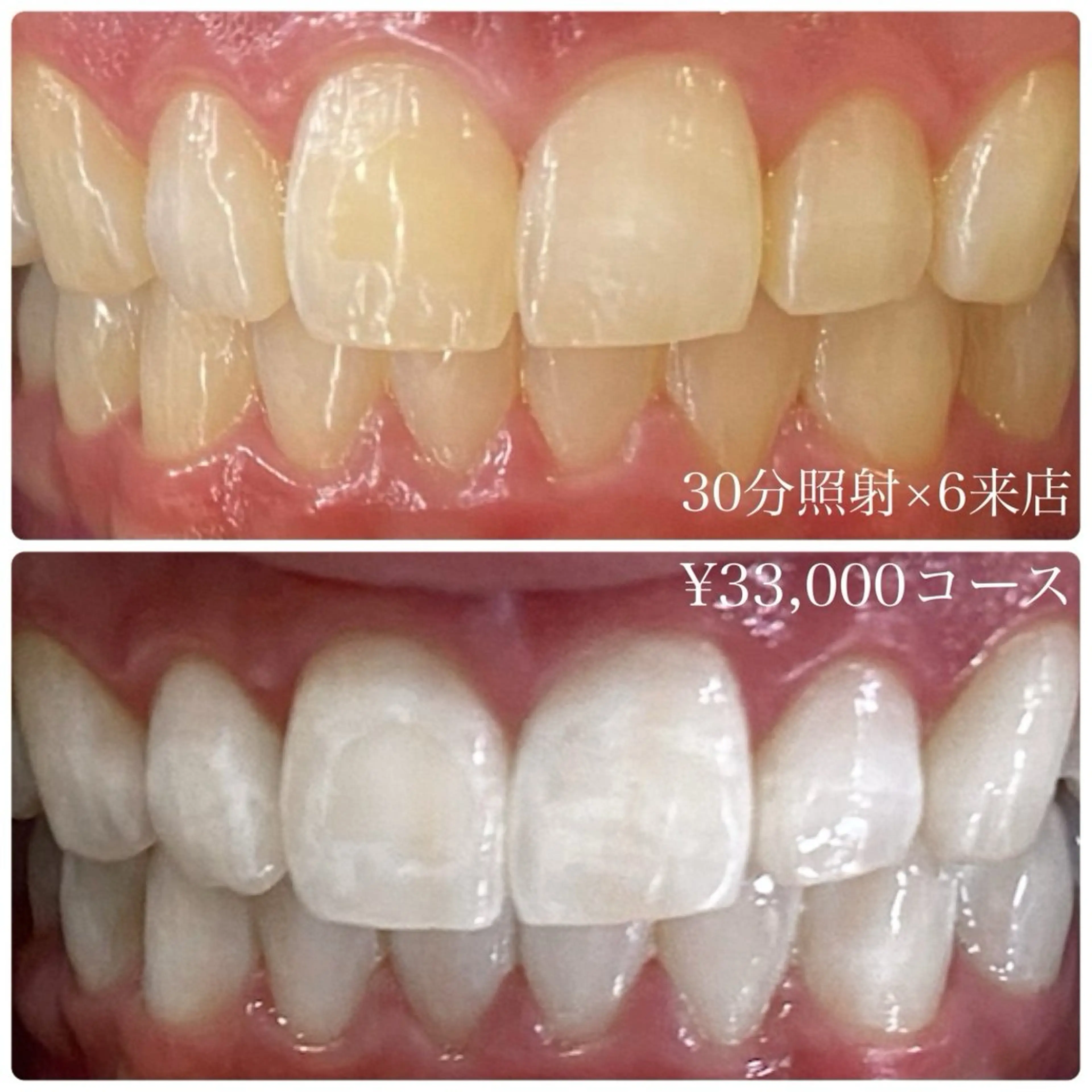 その他 PLATINUM Beauty 横浜店所属・ホワイトニングルーム 横浜店のその他イメージ