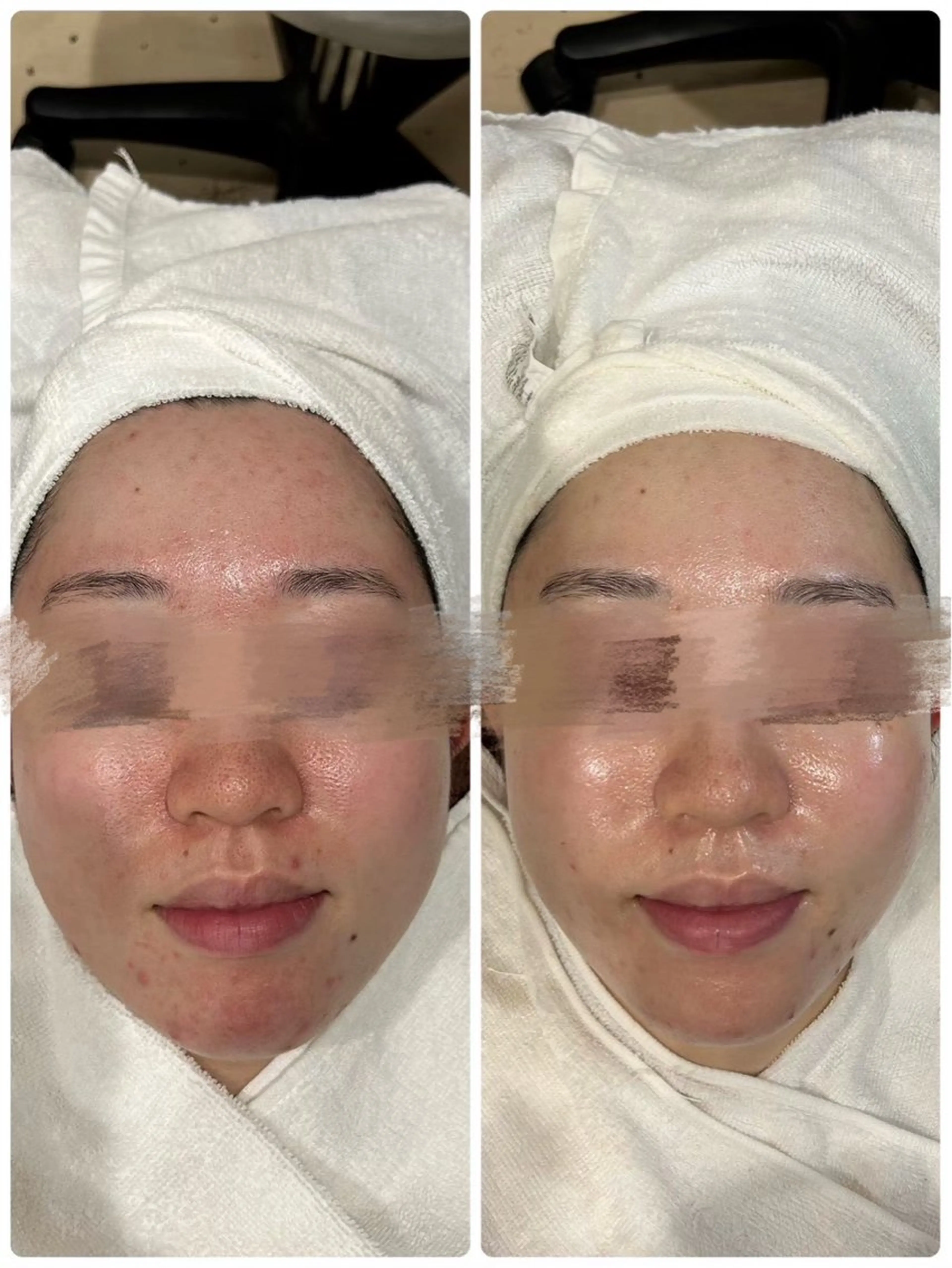 エステ ˚⟡ suwan .˚⟡のエステ・リラクイメージ