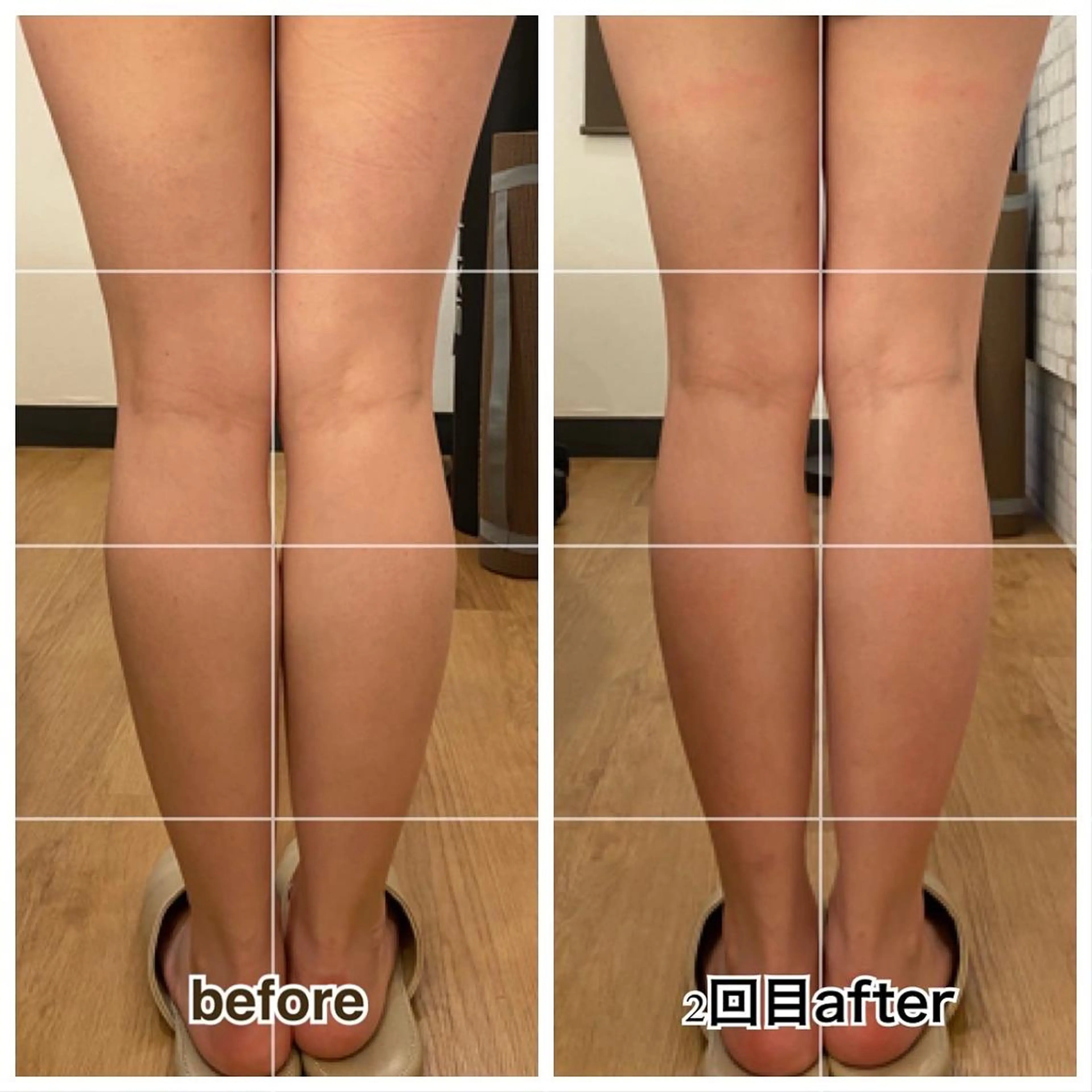 【小顔矯正】 salonaceのエステ・リラクイメージ