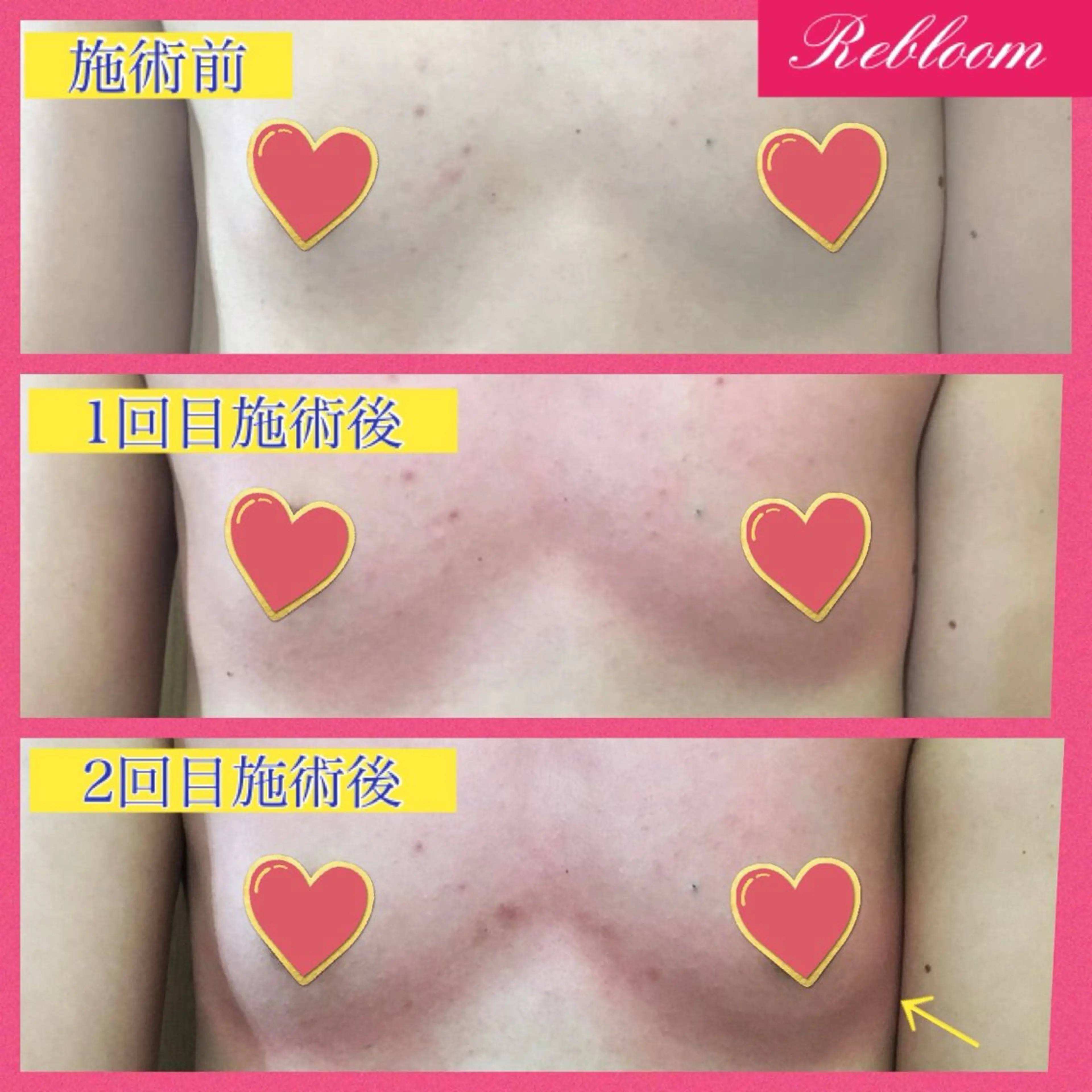 エステ デリケートな悩み解決 Rebloomのエステ・リラクイメージ