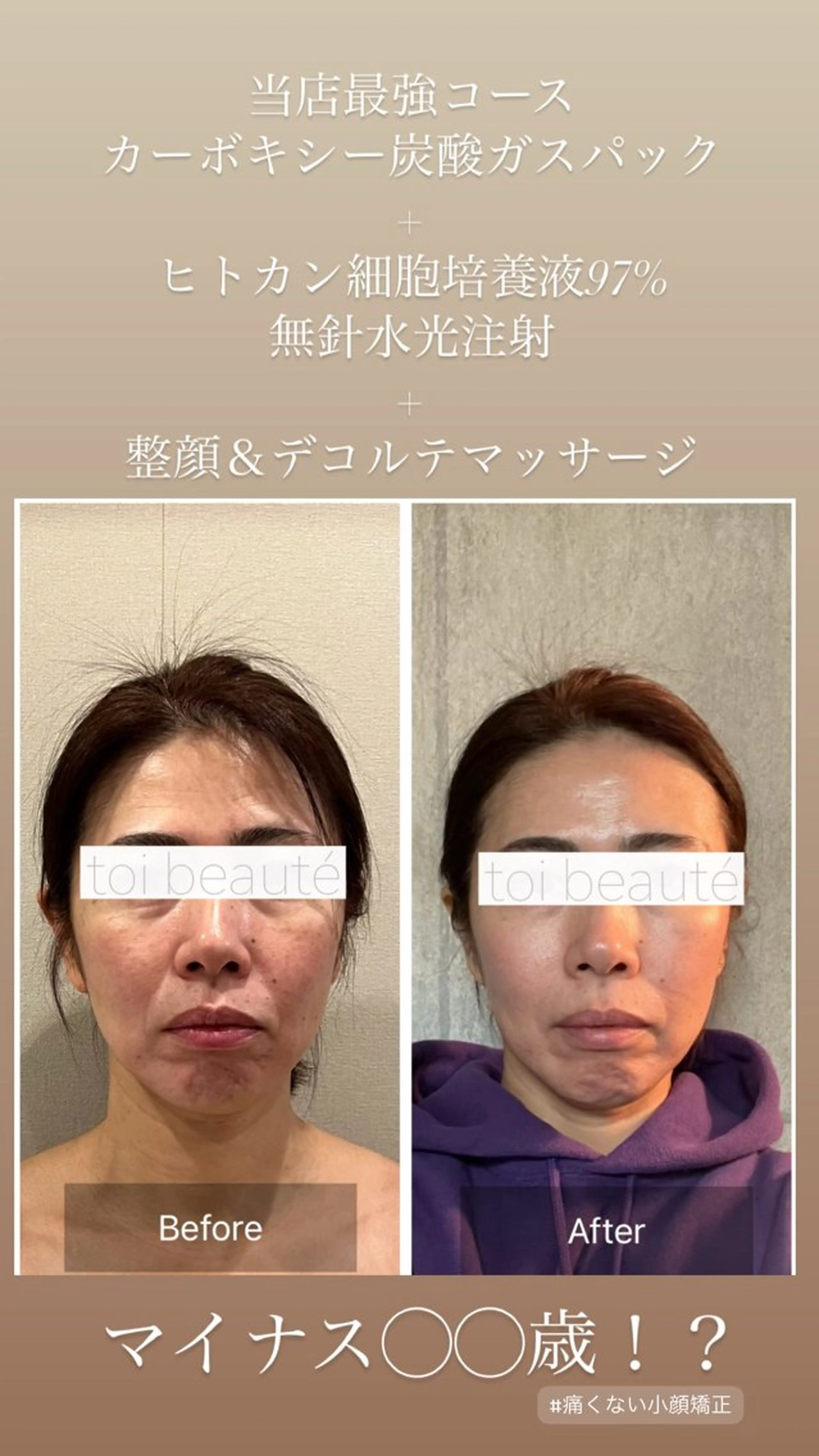 柳瀬 絵美のマツエク・マツパデザイン