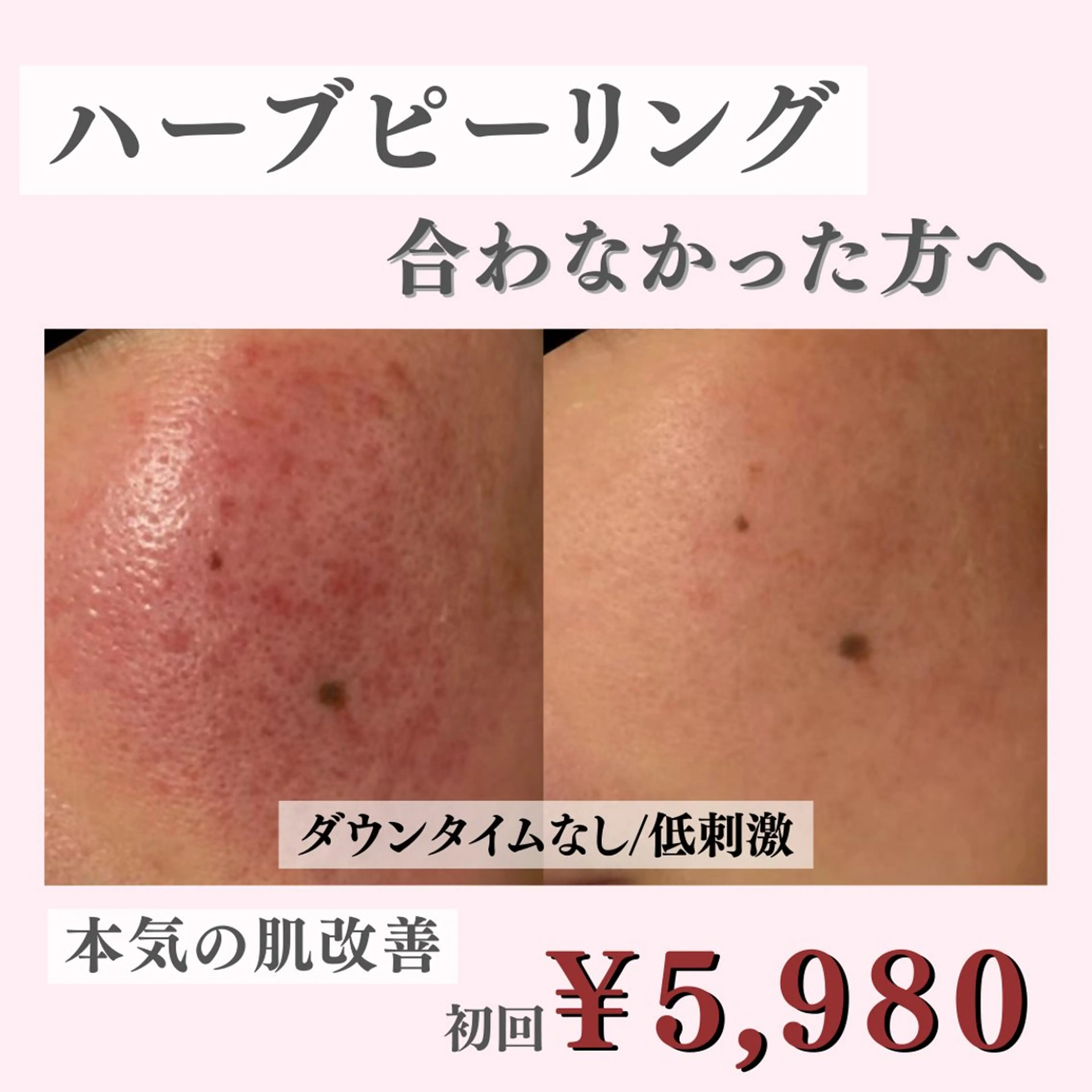 エステ リラク ニキビ・肌質改善専門 ♡人生が変わるサロンのエステ・リラクイメージ