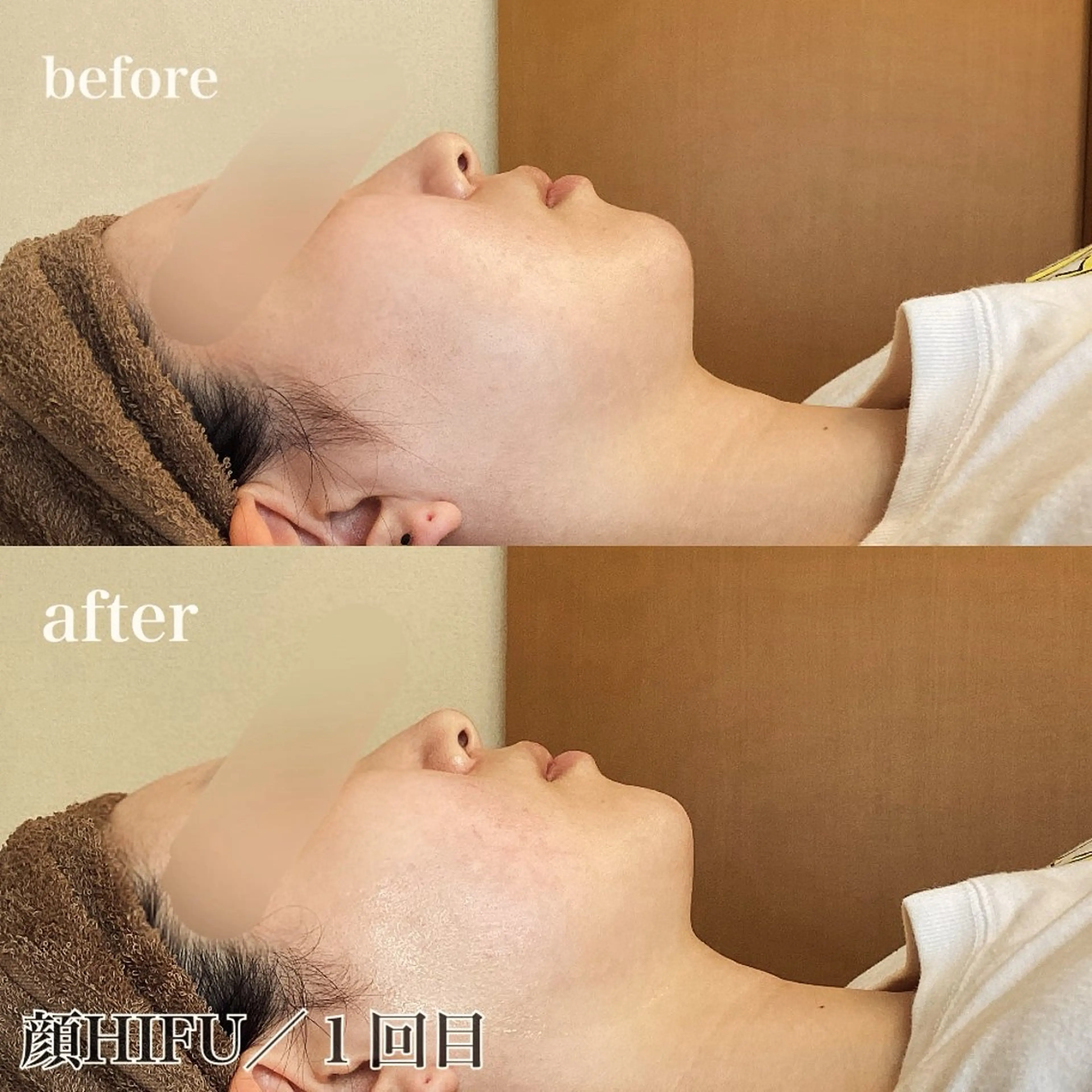 磐田｜LAYLA 一番丁寧な脱毛店のエステ・リラクイメージ