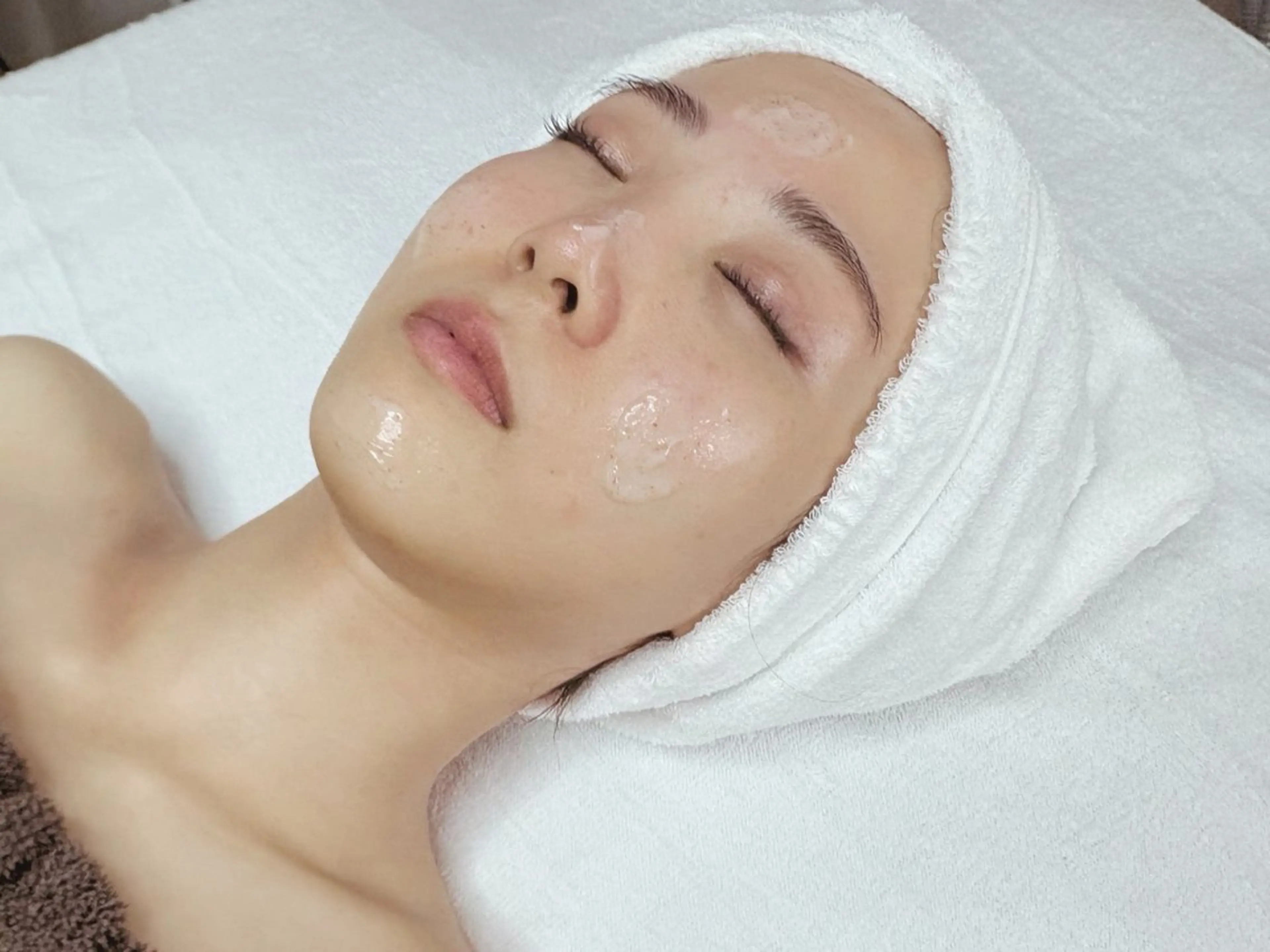 エステ 池袋ニキビ毛穴改善 🌿ハーブピーリングのエステ・リラクイメージ