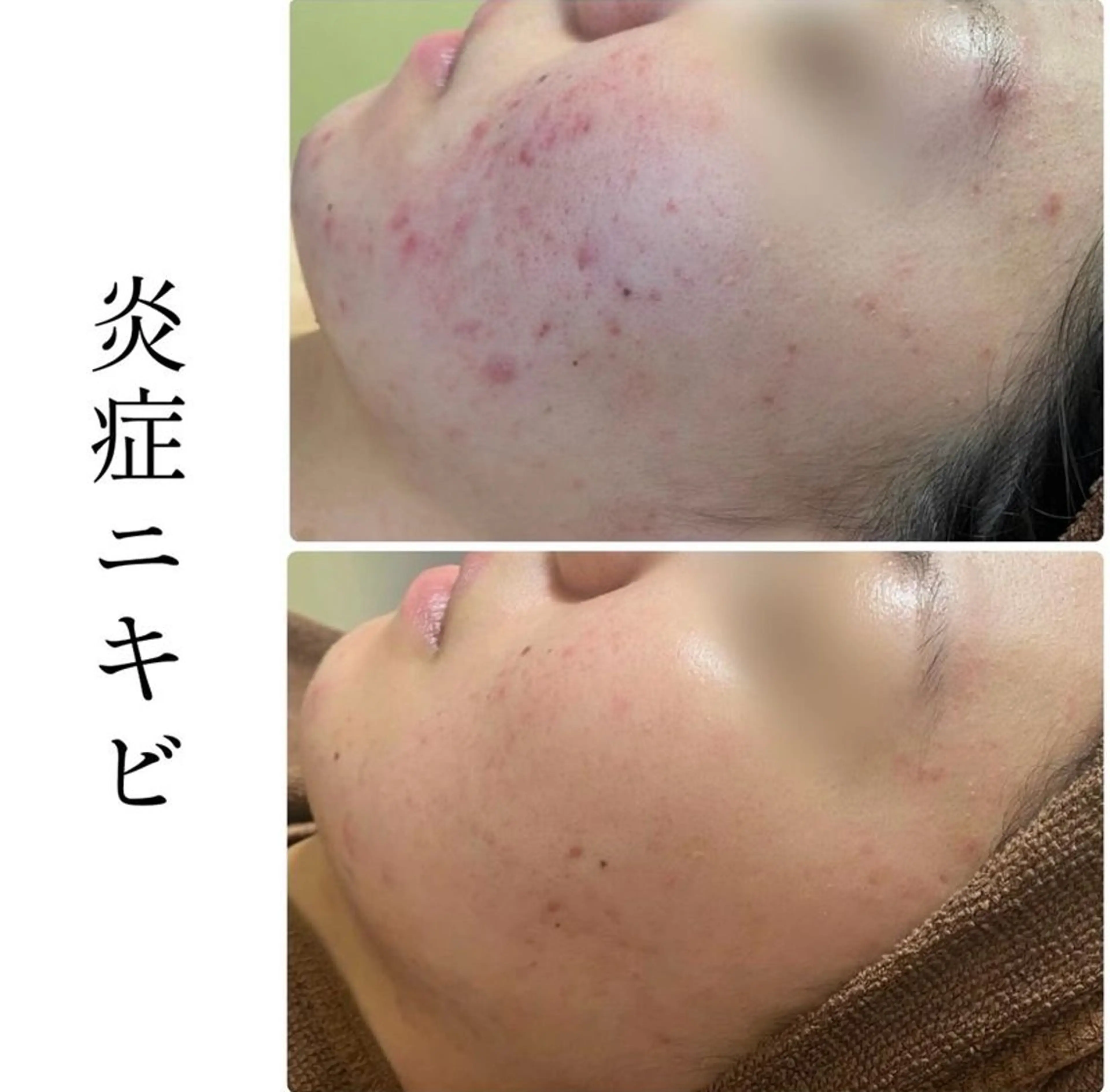 エステ ハーブピーリング専門 BIOPLUS＋川崎のエステ・リラクイメージ