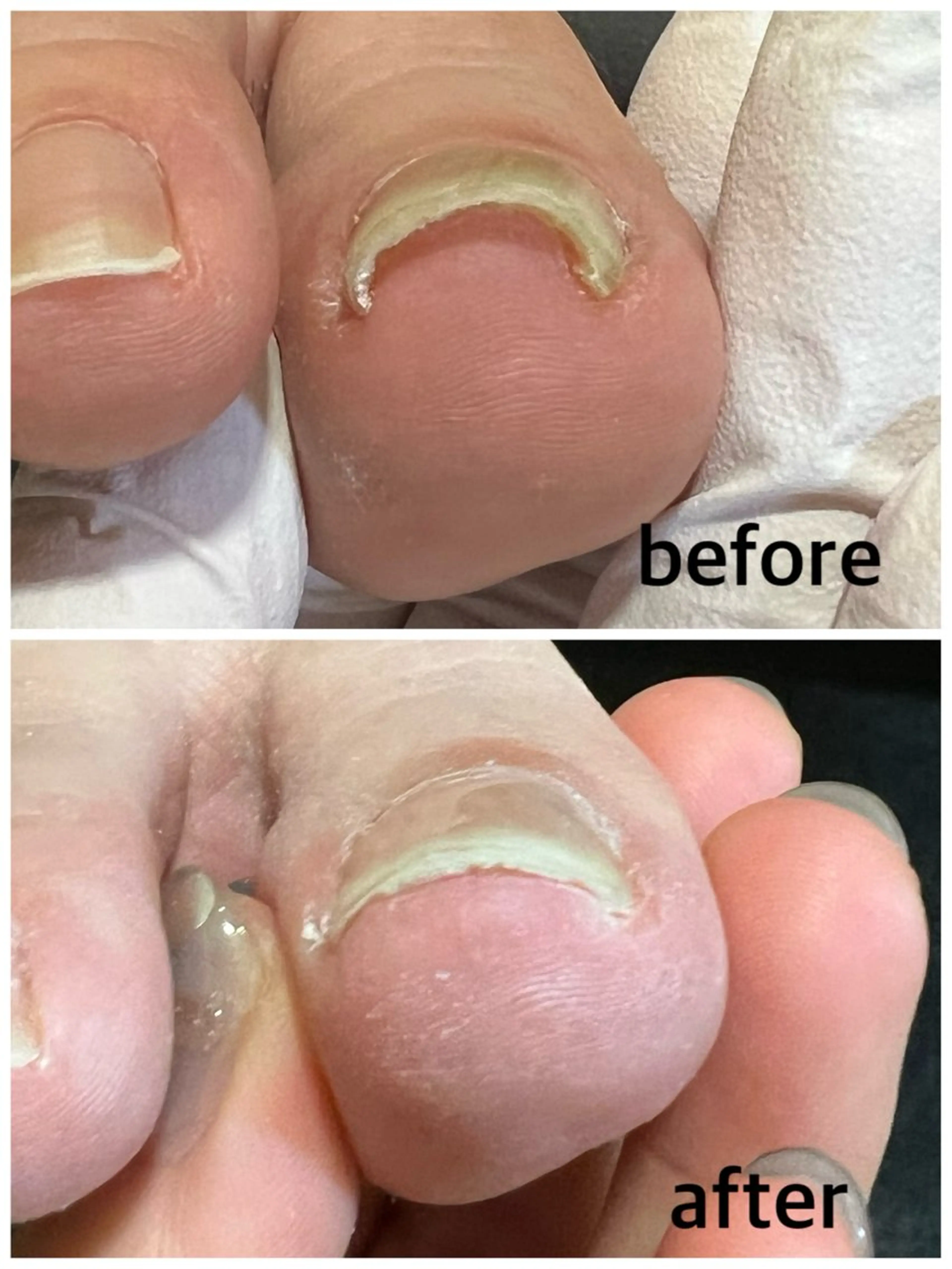 ネイル フットネイル 巻き爪補正店 堺東店のネイルデザイン