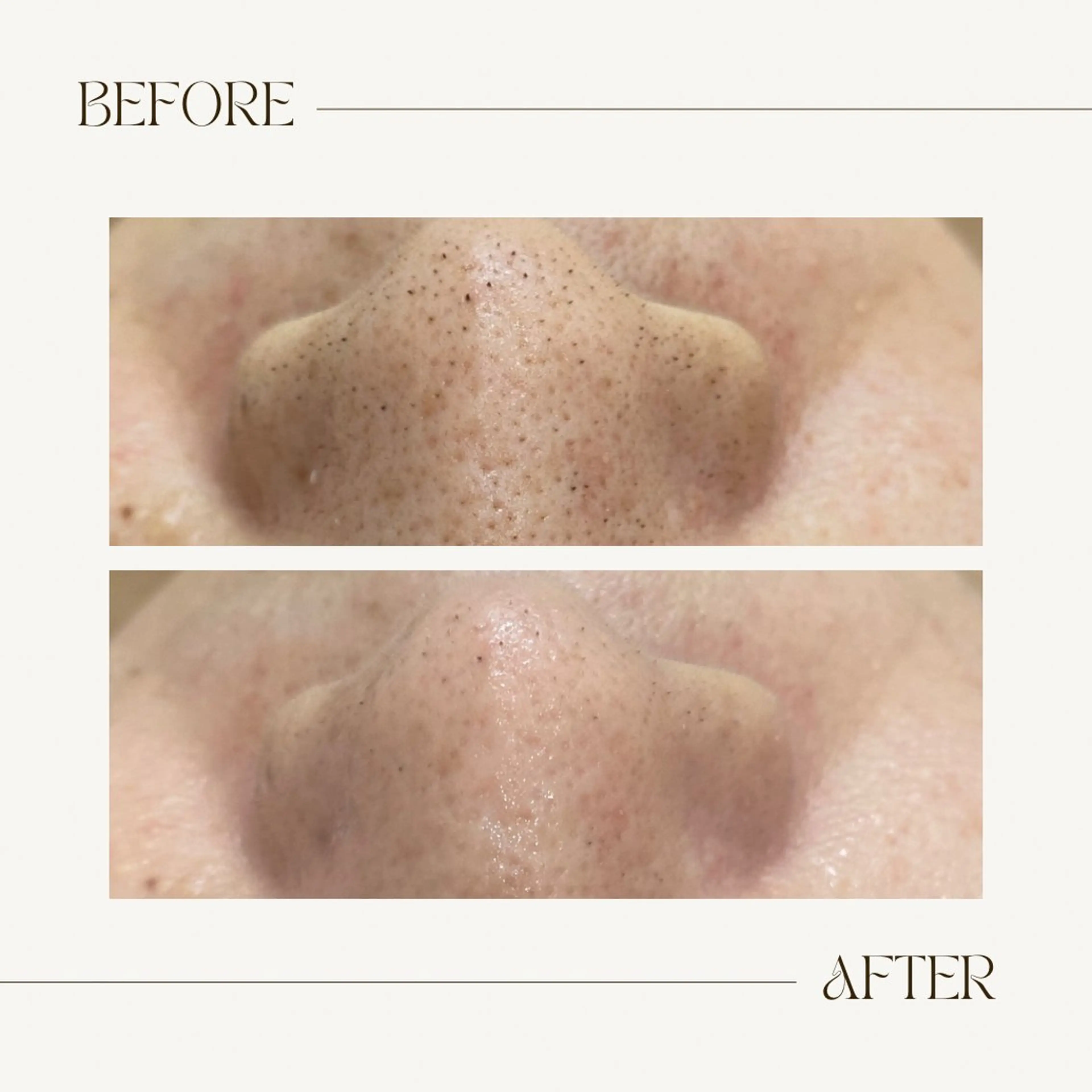 CEsalonEgg 齋藤のエステ・リラクイメージ