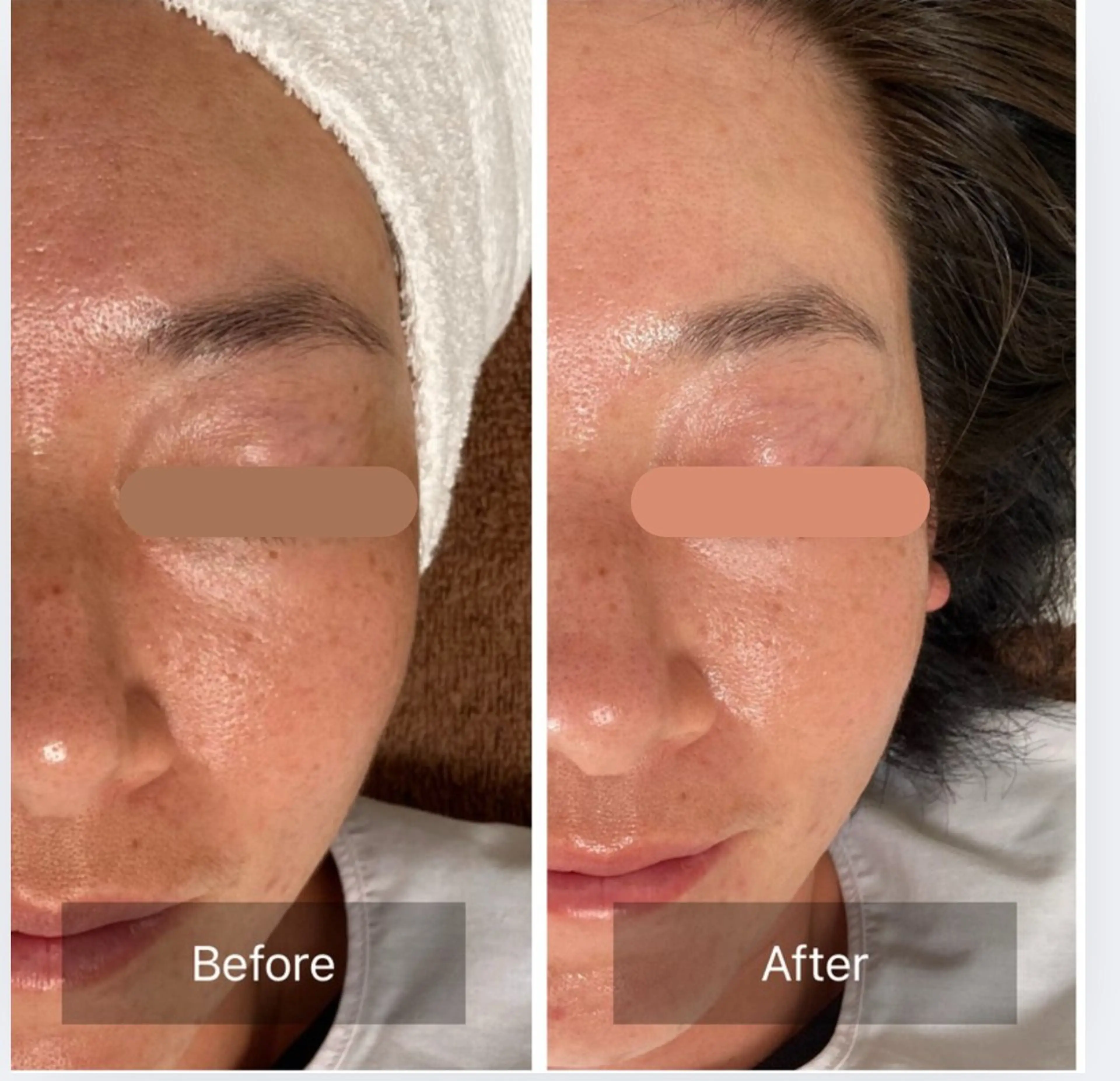 エステ 小顔リフト整顔/ 美肌サロンのその他イメージ