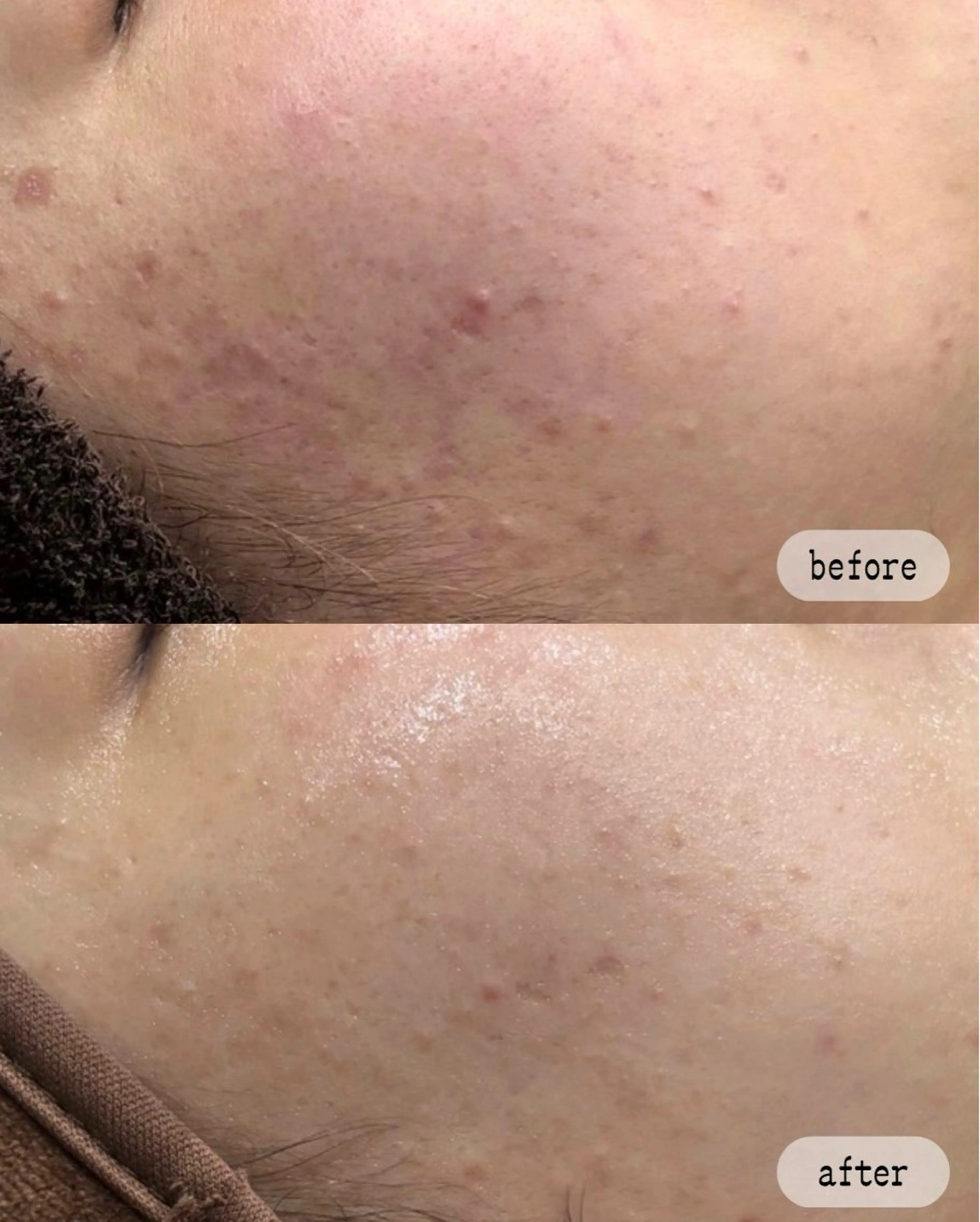 エステ LaVibe ann.のエステ・リラクイメージ