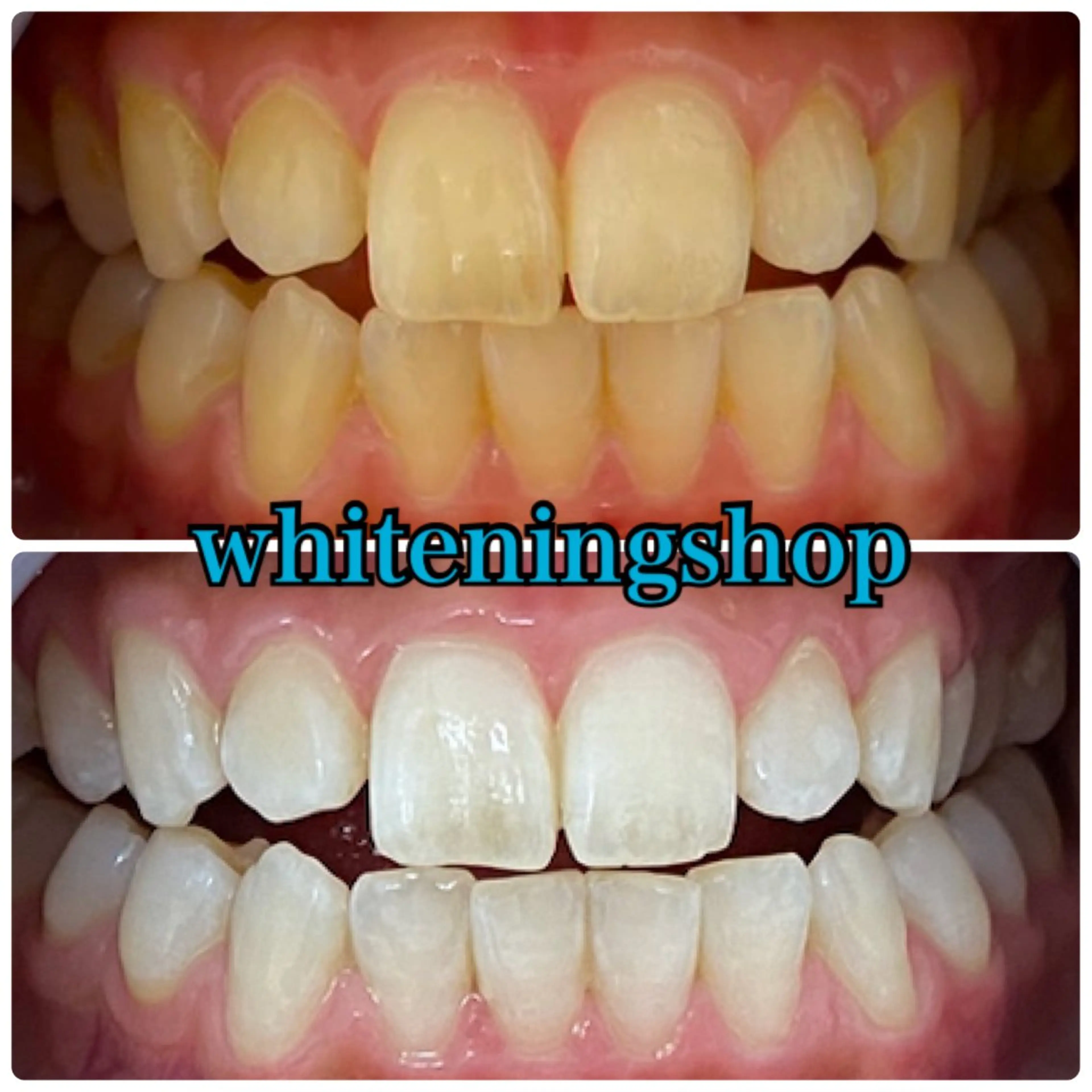 エステ リラク ホワイトニング ショップ吉祥寺店のエステ・リラクイメージ