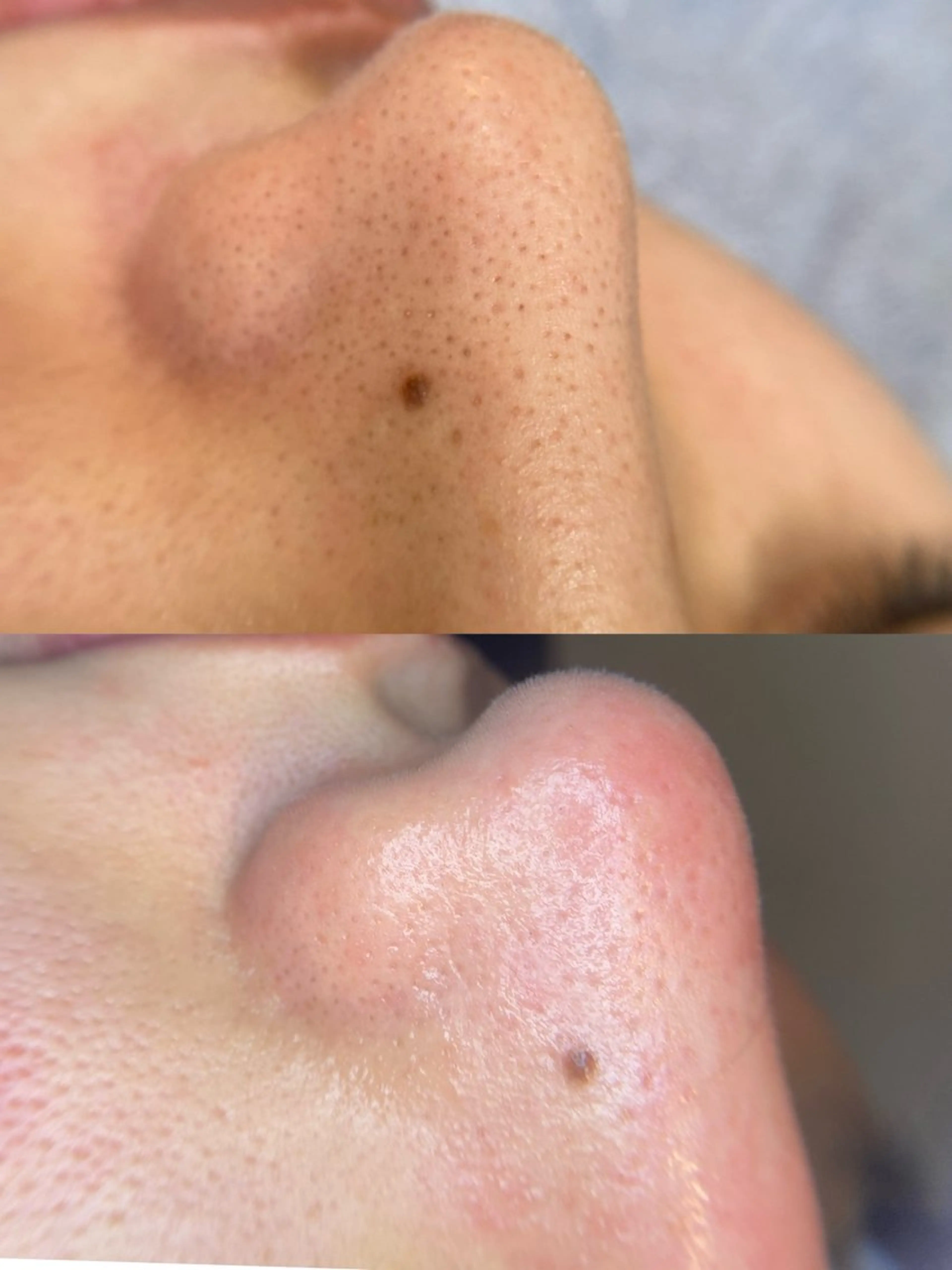 メンズ メンズ韓国風 韓国式３D毛穴洗浄＆ 脱毛vive京橋のエステ・リラクイメージ