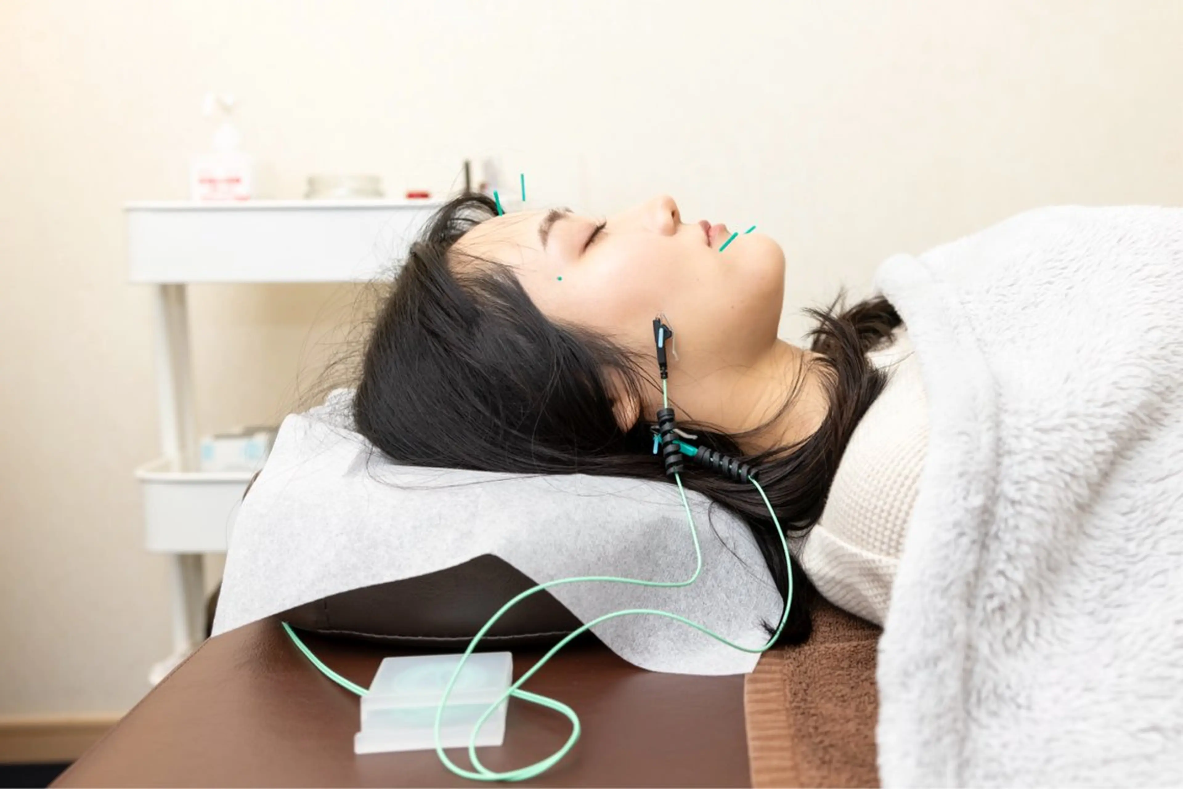 【理想の小顔へ】美容鍼＋小顔矯正💖💫モニター価格💫の写真